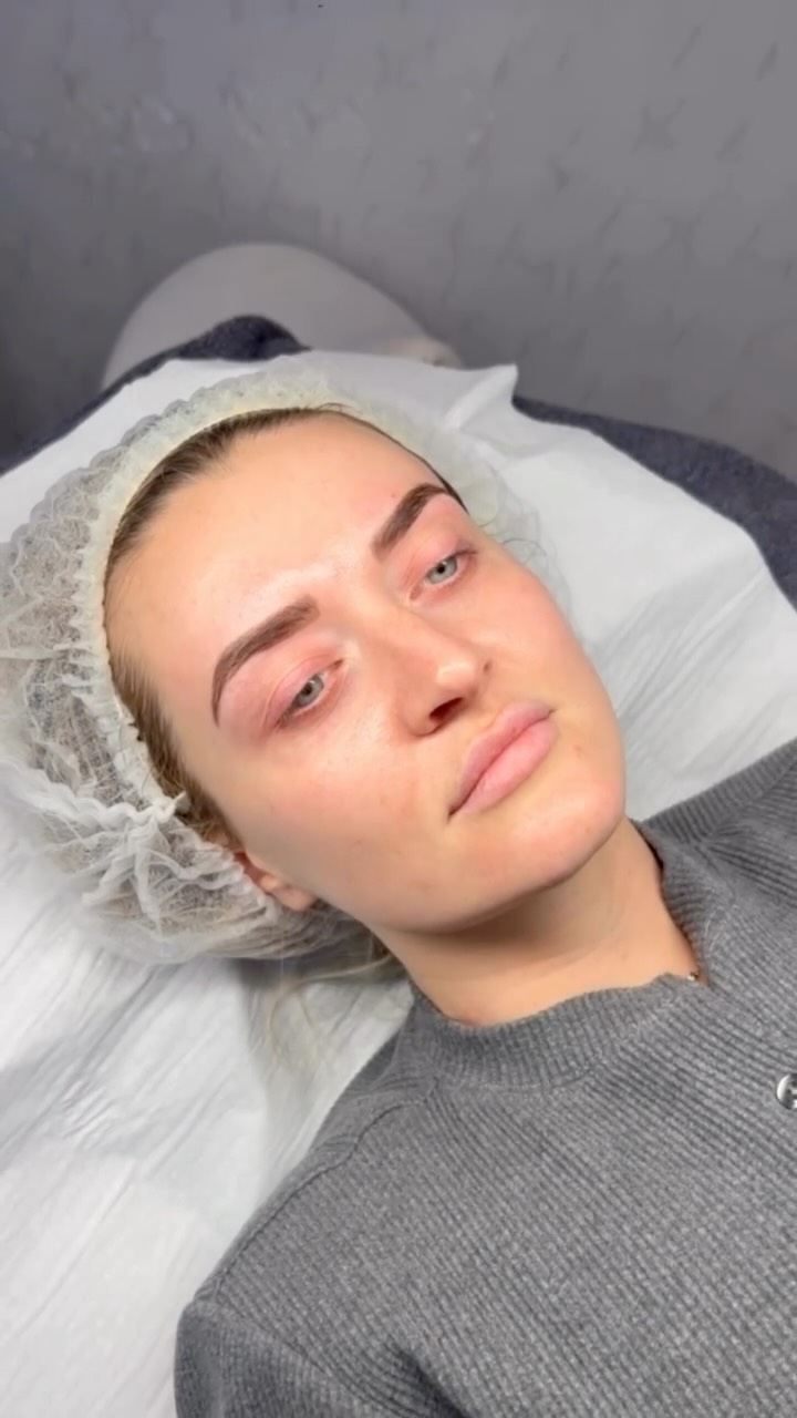 3D Hydro Facial Glow ✨
Want instantly glowing, hydrated skin with zero downtime? This is the facial everyone is talking about. 💧
What is the 3D Hydro Facial?
The 3D Hydro Facial is a multi-step treatment designed to deeply cleanse, exfoliate, extract impurities, and intensely hydrate the skin—leaving you with a fresh, radiant glow.
Benefits:
✔️ Deeply cleanses and detoxifies the skin
✔️ Instantly hydrates and nourishes
✔️ Improves skin texture and tone
✔️ Helps reduce congestion and blackheads
✔️ Leaves your skin glowing and refreshed
Perfect before events or as part of your regular skincare routine to keep your skin looking its best. ✨
At Elite Nurse Led Aesthetics, we focus on results-driven treatments that leave your skin healthy, radiant, and glowing.
📍 Wakefield
📩 Message us to book your appointment or send us a DM to start your skin journey today.
#HydroFacialWakefield #SkinGlow #EliteNurseLedAesthetics #WakefieldSkinClinic #GlowingSkin