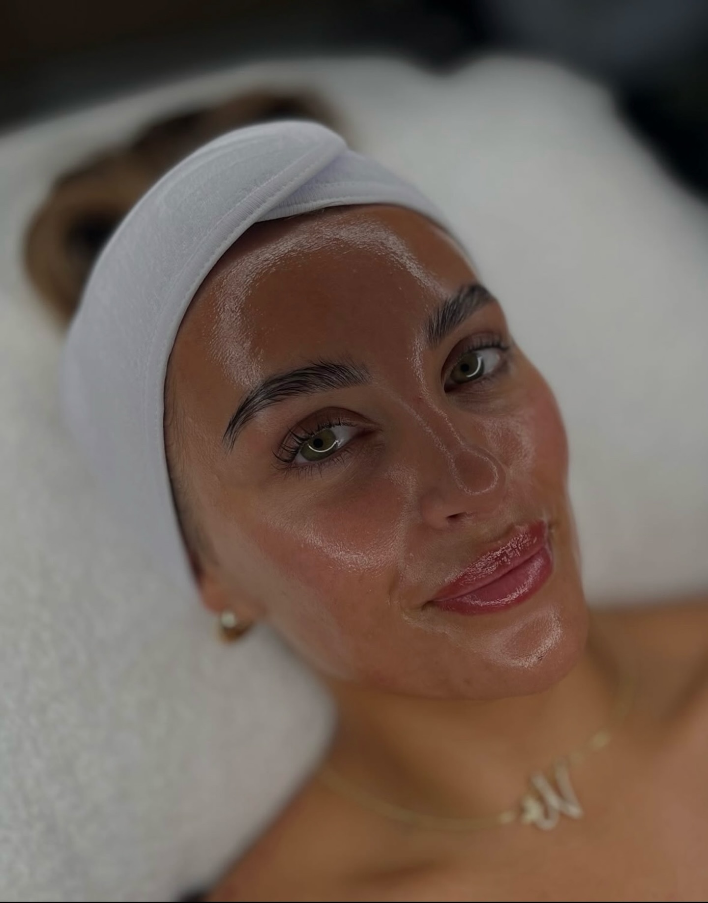 HydraFacial is a skin treatment that focuses on deep cleansing and hydration at the same time.
During the treatment, the skin is gently exfoliated, pores are cleaned, and nourishing serums are infused into the skin. This is done with a device that works in a controlled and precise way, making it suitable for almost every skin type.
The goal is simple:
cleaner skin, better hydration, and a more even texture.
It can help with:
• clogged pores
• dull or tired-looking skin
• dehydration
• mild acne
At Lana Skyn, the treatment is adjusted based on what the skin needs that day, using products like Toskani to support the skin barrier instead of irritating it.
There is no downtime, and the skin usually looks more fresh and balanced afterwards, not over-treated.