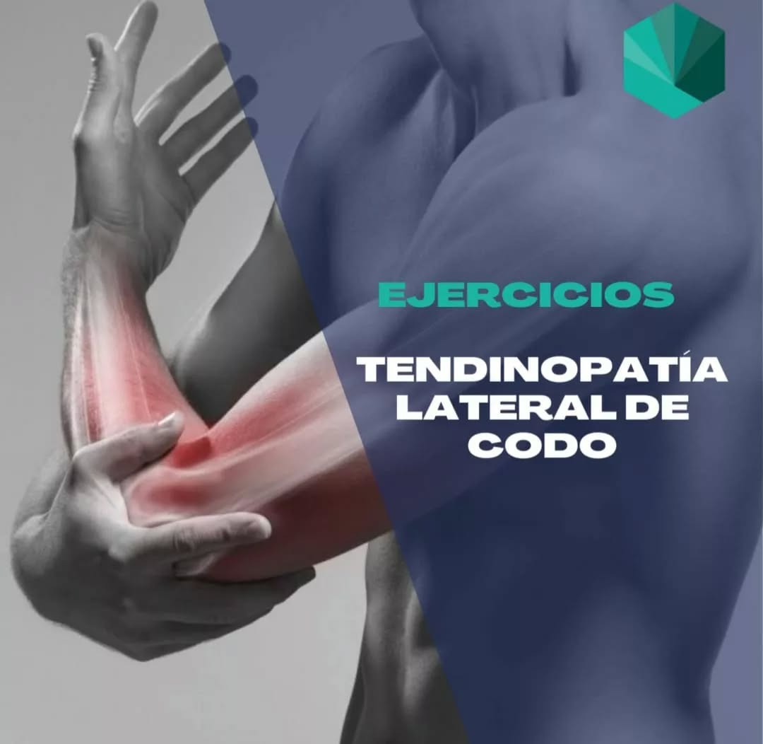 📢¡TENDINOPATÍA LATERAL DE CODO!
🔛También conocida anteriormente como codo de tenista o epicondilitis. Este trastorno se caracteriza por la presencia de dolor generado en la región tendinosa de la musculatura que inserta en epicondilo lateral del húmero.
🎯 Se caracteriza por ser un dolor localizado en la anterior y proximal del epicondilo lateral del codo y frecuentemente se irradia hacia a la musculatura del antebrazo.
🤸🏽♂️Estes tendinopatías son habituales en gente que realiza movimientos repetitivos de flexión y extensión de muñeca asociados a gestos de agarre. El dolor tiende a aparecer con la actividad y no altera la movilidad de la articulación.
🏋🏻♀️📝En este post os queremos mostrar un ejemplo de progresión de ejercicios para una persona con este tipo de patología. Recordad que antes de hacerlos, es importante acudir a un especialista que conozca el caso y realizar un programa individualizado en función de cada caso.
💚¡Esperemos que os guste! Desde ValTem os deseamos un buen inicio de semana