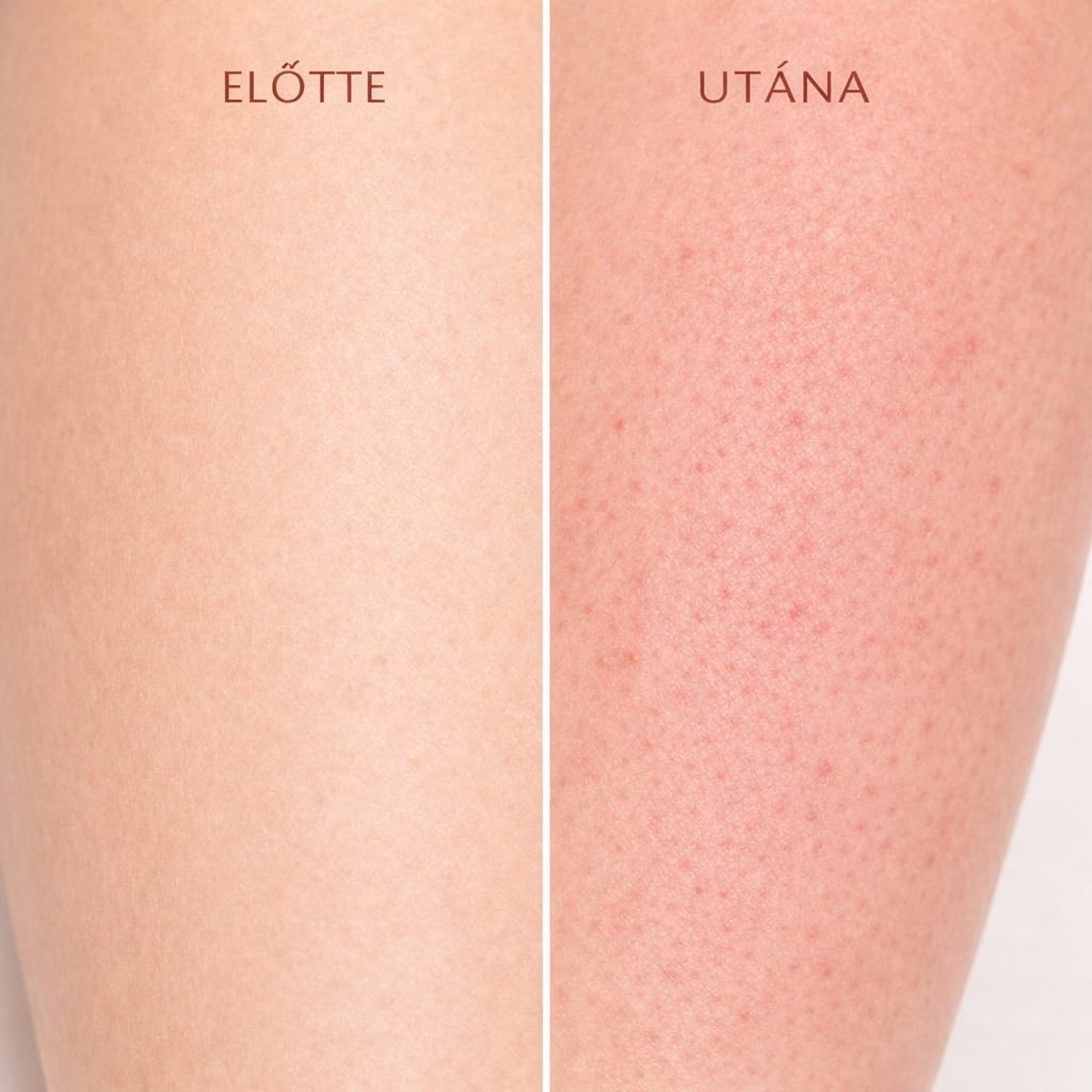 MIÉRT PIROSODIK KI VALAKI JOBBAN GYANTÁZÁS UTÁN?
Nem csak az „érzékeny bőr” számít…
👉 amikor a szőrt eltávolítjuk, a szőrtüsző körül apró mikrosérülések keletkeznek
👉 erre a tested azonnal reagál: fokozza a véráramlást a területen
👉 ezért jelenik meg a pirosság
De hogy KINÉL mennyire látszik, az több mindentől függ 👇
✨ mennyire erős a keringésed
✨ mennyire vékony / világos a bőröd
✨ mennyire sűrű a szőrnövekedés
✨ mennyire vagy „reaktív” bőrű
Ezért van az, hogy:
👉 valaki alig piros
👉 más látványosan de ez nem jelent rosszabb eredményt
Sőt 👇
💡 sokszor az reagál intenzívebben, akinek a szervezete gyorsabban „dolgozik”
+1 AMIT KEVESEN TUDNAK:
👉 meleg zuhany előtte
👉 edzés / felpörgött keringés
👉 koffein
mind fokozhatja a pirosságot 👀
⚠️ Tipp a pirosság csökkentésére:
👉 kerüld a meleg zuhanyt közvetlenül gyantázás után
👉 ne eddz közvetlenül a kezelés után
👉 koffeint lehetőleg ne fogyassz azonnal utána
💬 Fontos:
A gyantázás utáni pirosság teljesen normális reakció, és általában pár órán belül csökken.
⚠️ Ami NEM normális:
ha 1-2 nap után is erős, fájdalmas, vagy nem csökken
További információ:
🌐 www.bodywax.hu
✉️ info@bodywax.hu
📞 (70) 773 7060