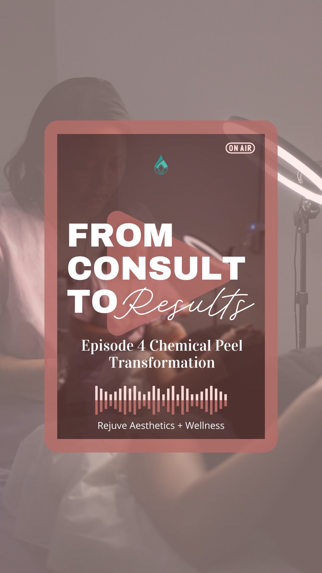 Consult â Results: The Hormonal Acne Edition đ
This client came in dealing with severe hormonal acne + dark spots from picking. Hereâs what we did:
⨠Started with VI Peel (first 2 treatments)
⨠Added microneedling to target pigmentation + texture
⨠Spaced treatments strategically (4 weeks â 2 weeks apart)
⨠6 series of each treatment = major transformation
Hereâs why this worked: She trusted the process AND stayed consistent with her at-home routine. Thatâs the magic combo.
Before you book: Start prepping your skin with a cleanser or serum containing salicylic acid OR glycolic acid (not both). This helps us see your true skinânot just dryness and irritation.
Your acne journey is unique. Letâs build a plan that actually works for YOUR skin.
đ Ready to start? Comment CONSULT to book your appointment.
#hawaiimedspa #medspalife #medspahonolulu #hawaiiaesthetic #hawaiiaestheicnurse