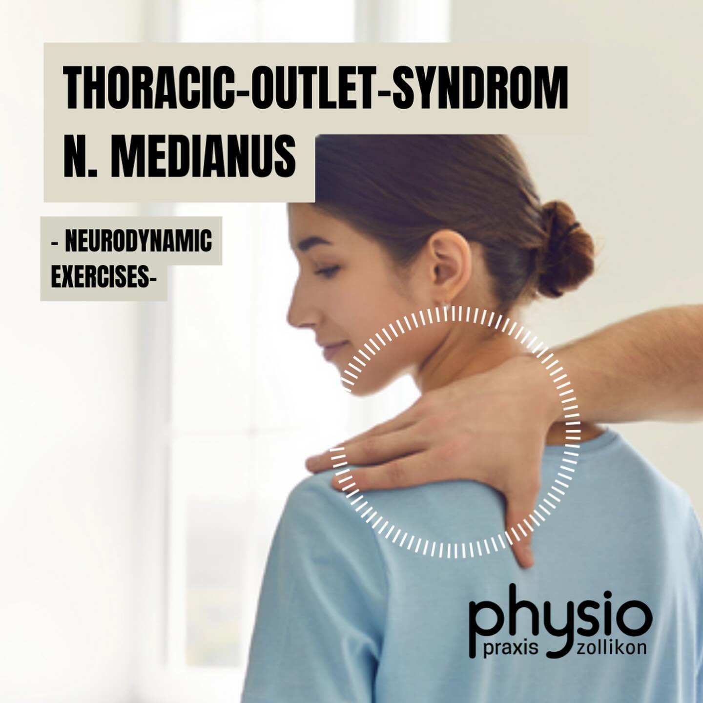 ‼️ Thoracic-Outlet-Syndrom des N. Medianus‼️
🧠🧐Das Thoracic Outlet Syndrom kann u.a. die Nerven betreffen, die den Raum zwischen dem Schlüsselbein und den Rippen passieren. Ist der Nervus medianus betroffen kann es zu unterschiedlichen Beschwerden kommen wie z.B. Taubheit, Kribbeln und Schmerzen im Arm, der Hand und den Fingern (insbesondere Daumen, Zeige- & Mittelfinger). Die Ursachen können variieren.
Durch Gleitmobilisation und Dehnungen des betroffenen Nervs kann die Mobilität des Nervs verbessert, sowie eine Schmerzlinderung und Funktionsverbesserung des Arms erzielt werden.
Hier seht ihr ein stufenweiser Übungsaufbau zur Verbesserung der Neurodynamik des N. Medianus:
1️⃣. Stufe: Verbesserung der Gleitfähigkeit des Nervs
- Slider: Kopf und Ellenbogen/Hand bewegen sich in gleiche Richtung dadurch wird eine Seite des Nervs angenähert und die Gegenseite gestreckt. Der Nerv bleibt im wesentlich in seiner Länge unverändert und gleitet lediglich
- Balance: Kopf rotiert zur nach oben asgerichteten Handinnenfläche
2️⃣. Stufe: Verbesserung der Dehnfähigkeit des Nervs
⚠️Diese Übung sollte erst im späteren Verlauf bei nur noch geringer Symptomatik mit Rücksprache des Therapeuten durchgeführt werden⚠️
- Tensioner: Kopf und Ellenbogen/Hand bewegen sich voneinander weg und bringen den Nerv somit auf Spannung.
Wir empfehlen bei den Übungen 2-3 Sätze täglich durchzuführen.
Haftungsausschluss: Die Inhalte werden mit großer Sorgfalt ausgearbeitet, ersetzen jedoch keine individuelle fachliche Untersuchung und Behandlung durch einen Arzt oder Physiotherapeuten.
⚠️💪🏽 Möchtest du einen individuelleren Reha- oder
Trainingsplan um deine Ziele zu erreichen, vereinbare gerne einen Termin in unserer Praxis. Denn Link dazu findest du oben in der Bio auf unserem Profil.
#rehab #exercises #training #neurodynamic #thoracicoutletsyndrome #mobility #mobilisation #neckpain #nervusmedianus #physiopraxiszollikon #health #physiotherapie #physio #physiotherapy #gesundheit #sport #training #fitness #therapie #physiotherapeut #physiolife #bewegung #moveyourbody #zollikon #zürich