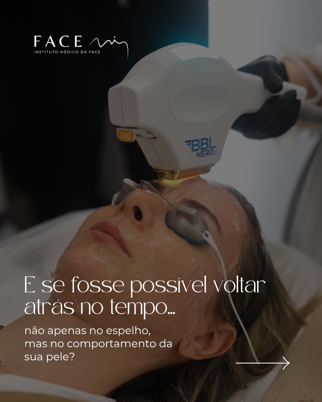 O futuro chegou 💫
Preservamos os processos biológicos que ajudam a pele a comportar-se de maneira mais jovem saudável e equilibrada com tecnologias como o BBL e o Halo.
Comece a cuidar da sua pele hoje. ✨
#bblheroic #facemi #luzpulsada #laserpele