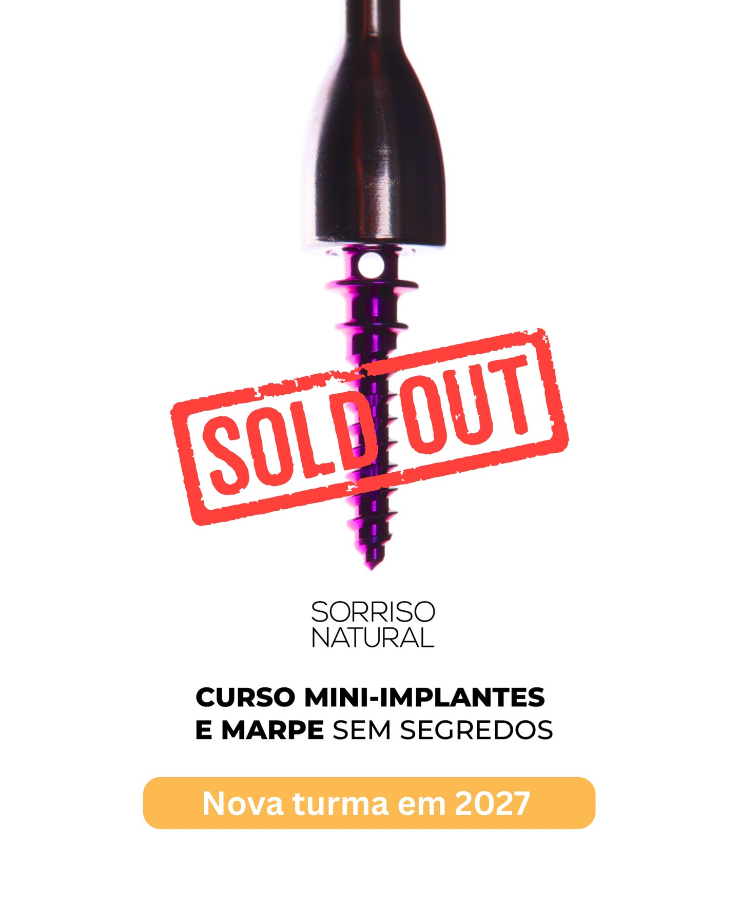 As vagas para o Curso Mini-implantes e MARPE Sem Segredos esgotaram… e foi em tempo recorde.
A todos os colegas que confiaram em nós: obrigada.
Prometemos dias intensos, exigentes e com muita aprendizagem — exatamente como a vossa prática clínica merece.
Para quem não conseguiu vaga, já temos lista de espera para a próxima edição.
👉 Podem deixar o vosso nome aqui:
https://www.ortodontiasemsegredos.com/listamini-implante
Os inscritos na lista terão:
✔ prioridade de inscrição
✔ acesso a condições especiais
Vemo-nos em breve ⏳