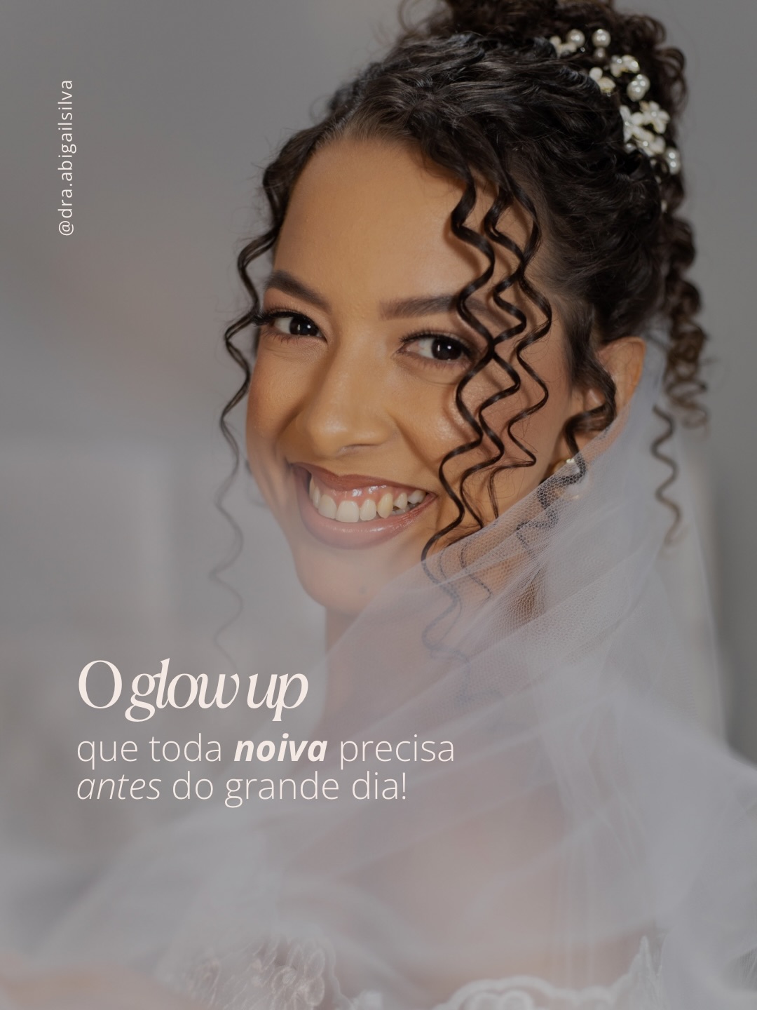 Cadê as noivinhas? ✨💍👀
Botox é pra você, mulher!
Cuide de tudo e não esqueça da SUA beleza como prioridade para o grande diaaa. Tem detalhes dessa minha paciente nos stories 😍 vai lá ver 🥰