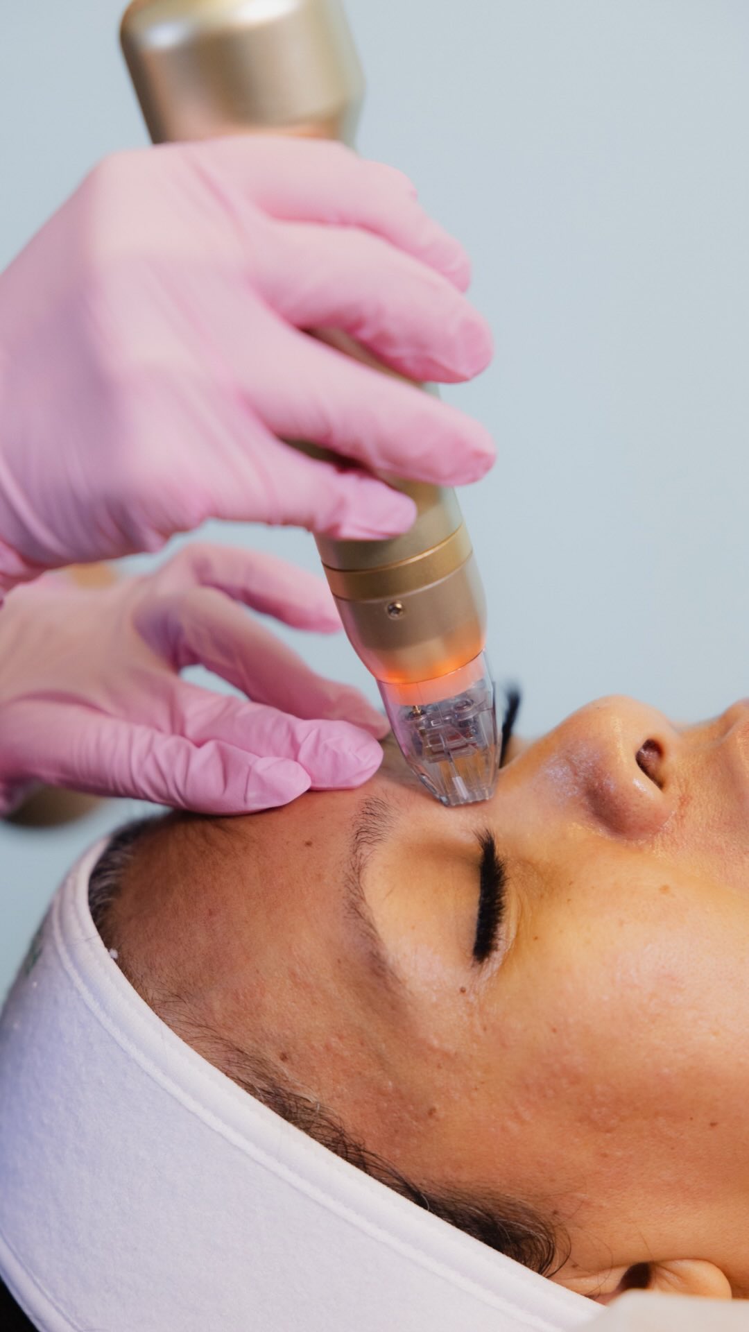 The girls glowing in summer start their lasers NOW đâ¨
Hereâs the thing most people donât know about laser treatments: Your skin needs TIME to complete its glow-up cycle.
đŠđťââď¸Weâre talking multiple sessions spaced weeks apart, plus recovery and collagen remodeling.
Starting Sylfirm-X treatments in March means by June youâre:
â
Done with downtime season
â
Past the âno sun exposureâ phase
â
Revealing that natural radiance when you actually want it
Why NOW is best for laser time:
âď¸ Less UV exposure = safer treatment windows
đ´ Hawaii spring weather = ideal healing conditions
â° Strategic timing = summer-ready results
đŤ Sylfirm-X targets tone, texture & tightness at once
This isnât a quick fix situation. This is planning ahead so your skin looks effortlessly amazing when it matters.
Ready to start YOUR glow timeline? Comment GLOW and weâll map out your personalized treatment series đ˛
#RejuveAesthetics #SylfirmX #LaserSeason #HonoluluMedspa