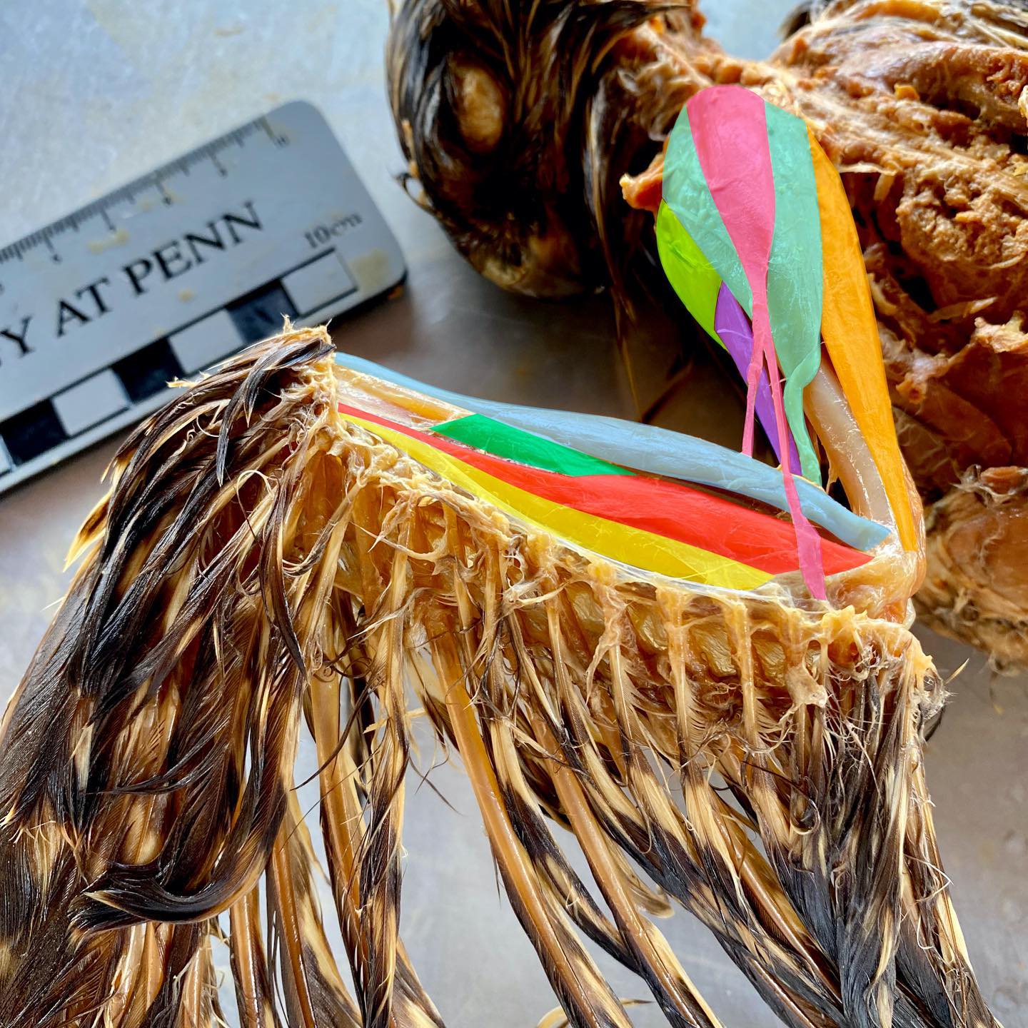 Hawk Dissection Part 6. I took a break from research to make something pretty. š I never tire of musculoskeletal anatomy, and had a lot of fun figuring out what was going on here:
.
On the shoulder and upper arm:
.
chartreuse - pectoralis m.
.
purple - biceps brachii m.
.
teal - deltoid m.
.
pink - tensor propatagialis m.
.
orange - scapulotriceps m.
.
Most of these are muscles we also have, but birds have a special tensor propatagialis muscle that humans donāt. This is actually part of the deltoid, and it attaches to the membrane of skin that stretches between the arm and forearm (called the patagium). This muscle helps the bird alter the tension in the patagium, thus aiding in control of flight!
.
Forearm muscles:
.
blue - extensor carpi radialis m.
.
red - extensor digitorum communis m.
.
yellow - extensor carpi ulnaris m.
.
green - supinator m.
.
These are muscles that extend the wrist (extensor carpi radialis and ulnaris) and the fingers (extensor digitorum). You also have these muscles in your forearm!
.
The supinator is extra cool. This muscle is what allows you to rotate your forearm so your palms can face up!
.
#science #scicomm #birdsofinstagram #hawk #anatomy #comparativeanatomy #dissection #livingdinosaur #supination #biceps #deltoids #pecs #muscles