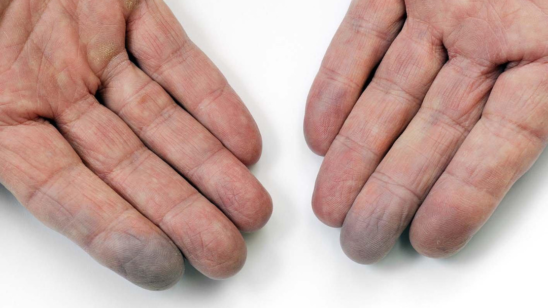 Hand-Arm Vibration Syndrome (HAVS) can develop slowly from regular use of vibrating tools. Learn the signs, prevention tips, and when to seek help in our latest post. Link in Bio
#HAVS #HandArmVibration #WorkplaceSafety #ConstructionLife #HealthAtWork #ToolSafety #SafetyFirst