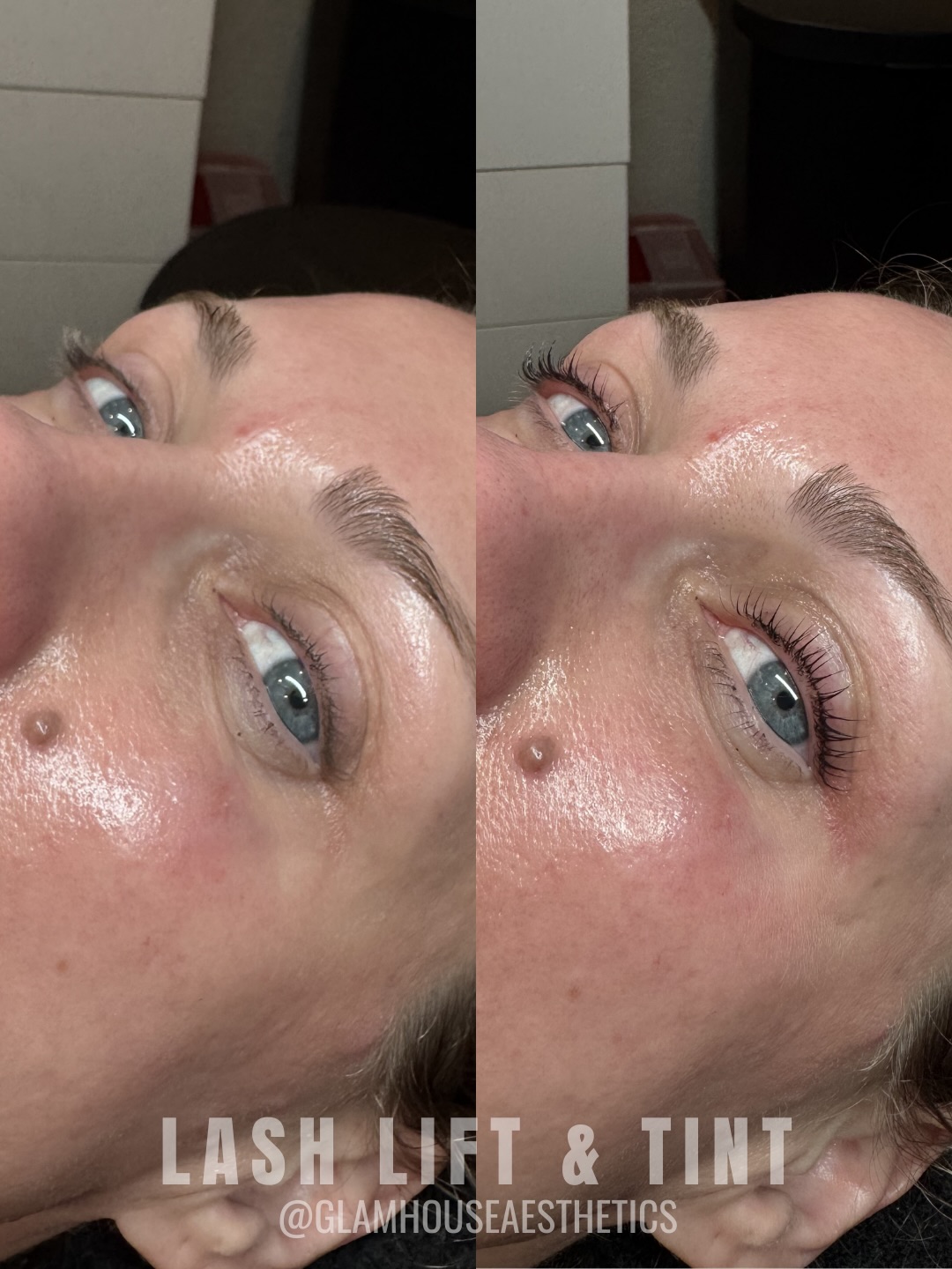 What if your morning routine didnât need mascara? đ¤Š
A lash lift and tint enhances your natural lashes by lifting them from the root and adding a rich tint that gives the look of darker, fuller lashes⌠No curler, no mascara, no extra steps. Itâs the perfect treatment for anyone who wants to wake up looking more put together with less effort in their daily routine.
Results are natural, low-maintenance, and designed to highlight the lashes you already have making it easier to feel ready for the day the moment you wake up.
⨠March Special Reminder: Lash Lift & Tint for just $85 this month only.
Appointments are limited, so send us a message or book your spot to take advantage of this special before the month ends!
Lash Lift & Tint by @cassieaesthetics_
#GlamHouseAesthetics #New BraunfelsMedspa #SanAntonioMedSpa #LashLift #LashTint