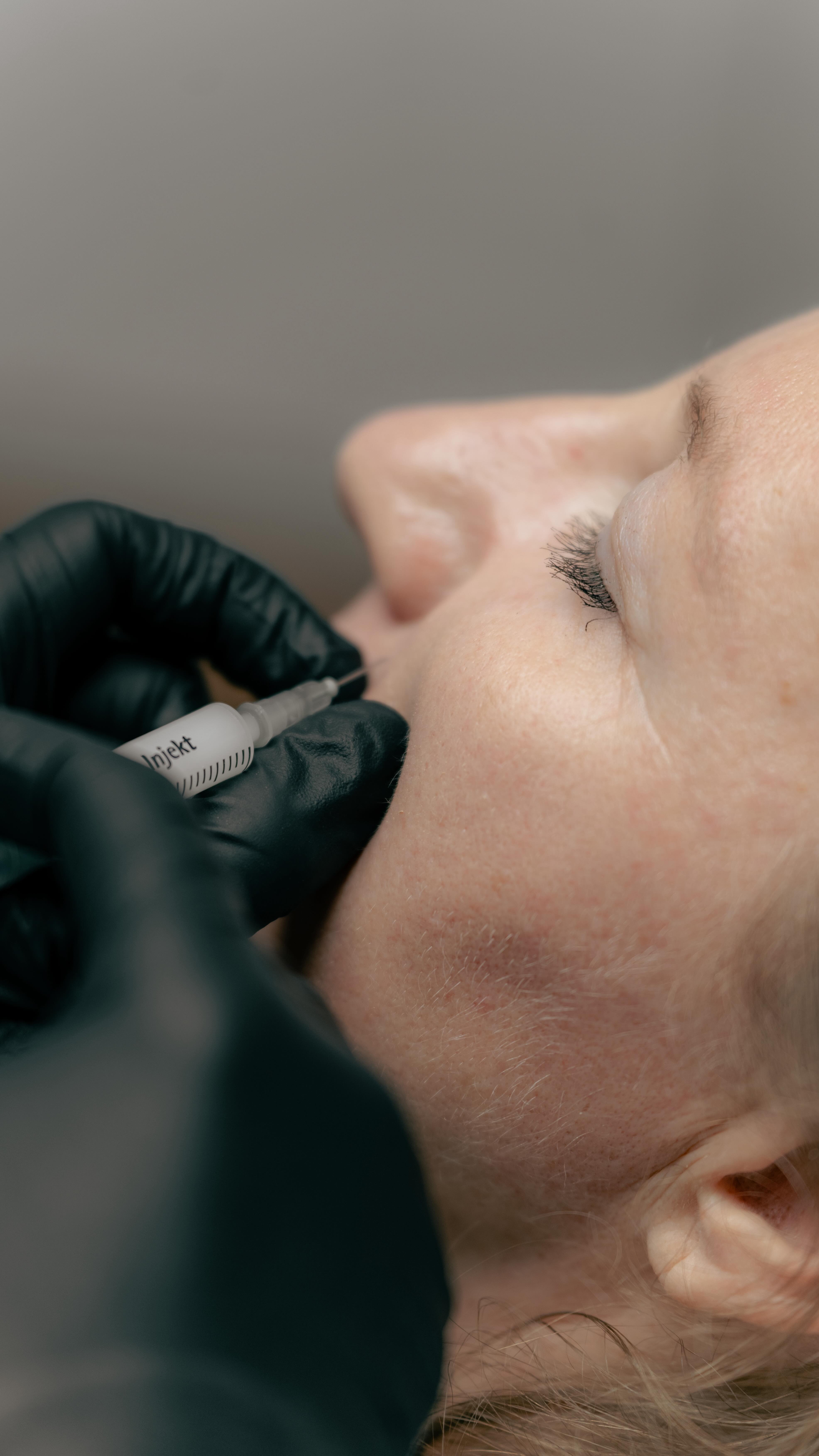 Sculptra® is a so-called biostimulator that stimulates collagen production. This results in skin tightening and rejuvenation from the inside out. The skin renews itself naturally.
-
Sculptra® ist ein sogenannter Biostimulator, der die Neubildung von Kollagen anregt. Auf diese Weise kommt es zu einer Hautstraffung und Hautverjüngung von innen heraus. Die Haut erneuert sich von selbst.
#sculptra #rejuvenation