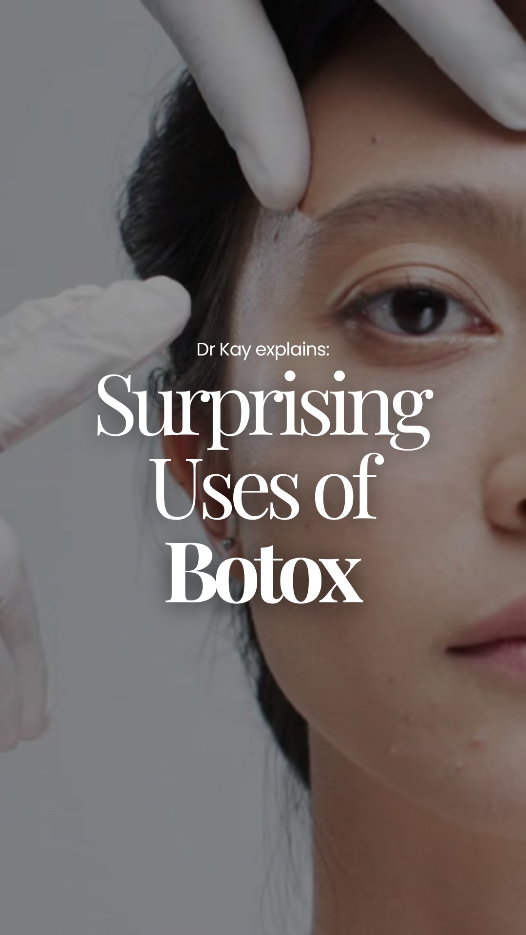 Think Botox is just for wrinkles? Think again. 👀
Dr Kay breaks down a few surprising ways Botox is used that most people don’t even know about, and some might actually apply to you.
From functional concerns to aesthetic tweaks, it’s not always what you expect…
🎥 Watch till the end to discover what Botox can really do