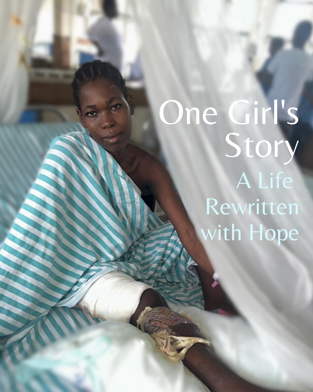 In Dar es Salaam, a 17-year-old girl arrived after a motor vehicle accident with a severe fracture to her lower leg and exposed bone. Injuries like this often require complex microsurgery…care that is unavailable in many parts of the world and frequently results in amputation.
For this young patient, that might have been the outcome. Instead, the RWI surgical team performed a delicate procedure, transferring muscle and skin from her back along with its blood vessels and reconnecting it to her leg using microsurgery. The operation was a success.
RWI has spent years working alongside local surgeons to teach and expand microsurgical skills in Tanzania. A key partner in this effort is Dr. Edwin Moringo, who has collaborated and trained with Dr. Andrea Pusic and the RWI team for more than a decade.
This partnership is more than surgical training - it is a lasting collaboration that is changing what is possible for patients and giving young people like this girl a chance to keep their limbs and their futures.
🕊️🤍
@reconstructingwomenintl
#womenhelpingwomen #donate #nonprofitorganization #reconstructivesurgery #surgeons
@reconstructingwomenintl @emilylaurenclark @mcoriddi @andrea.pusic @obrienjen17 @marianagoots @nvlmedicalaesthetics @dr.sarah.von.isenburg @dr.neuhannlorenzplasticsurgery
@dr.sarah_isenburg @katharina_isenburg @caitg.kwok @lhelliwellmd @pursuitofhapp.ines @maryanneog @rita_joana @mariechristinematthieu @just_geofrey
@emilylaurenclark @alexeshazenmd @drtraceyathompson @kavirangmd @323shell @martinagreminger @dr.neuhannlorenzplasticsurgery @sue_dawson_1964 @drtonizhong @drtinamoon @daniellerochlinmd @nobert255