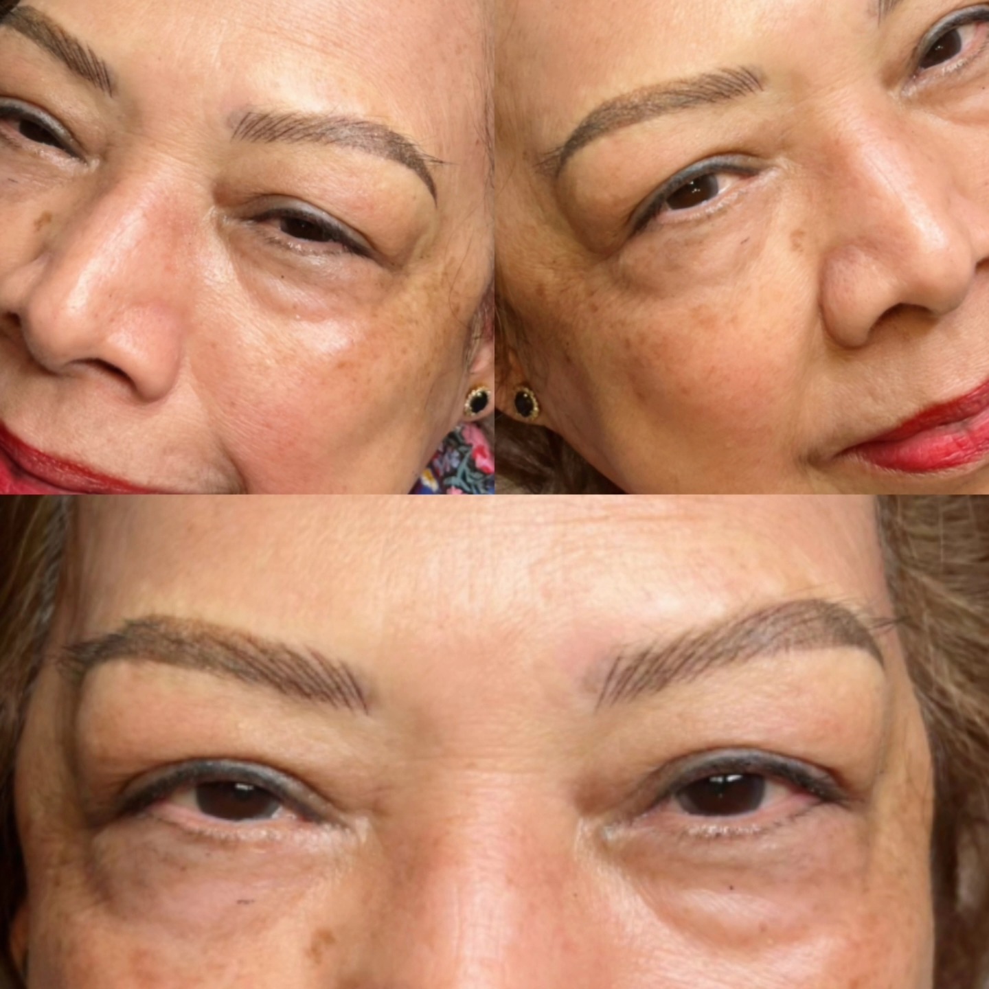 "Faded Eyebrow Tattoo? We got you. 😊
Huge thanks to @MrsJulie for trusting us with her brow transformation! As one of the lucky winners of our Australian Day Family Fun Fair give away, she chose to convert her KST facial treatment to a brow makeover (paying for the price difference, of course).
Her previous tattoo faded and she wanted a natural look, so we worked our magic with a combination of nanostrokes and ombre shading to blend seamlessly into her natural brows. Can’t wait to see her final look after the touch-up with additional hairstrokes! ✨
BOOK NOW!
https://www.kewskintherapy.com.au/
Kew Skin Therapy
📍174 High Street, Kew, VIC 3101
📞(03) 9853 4544
#Kewskintherapy #highlights #skinclinic #skinscience #melbourne #Hawthorne #Toorak #BrowTransformation #Nanostrokes #OmbreShading #BrowGoals #Grateful #cosmetictattooing #brows #semipermanentmakeup