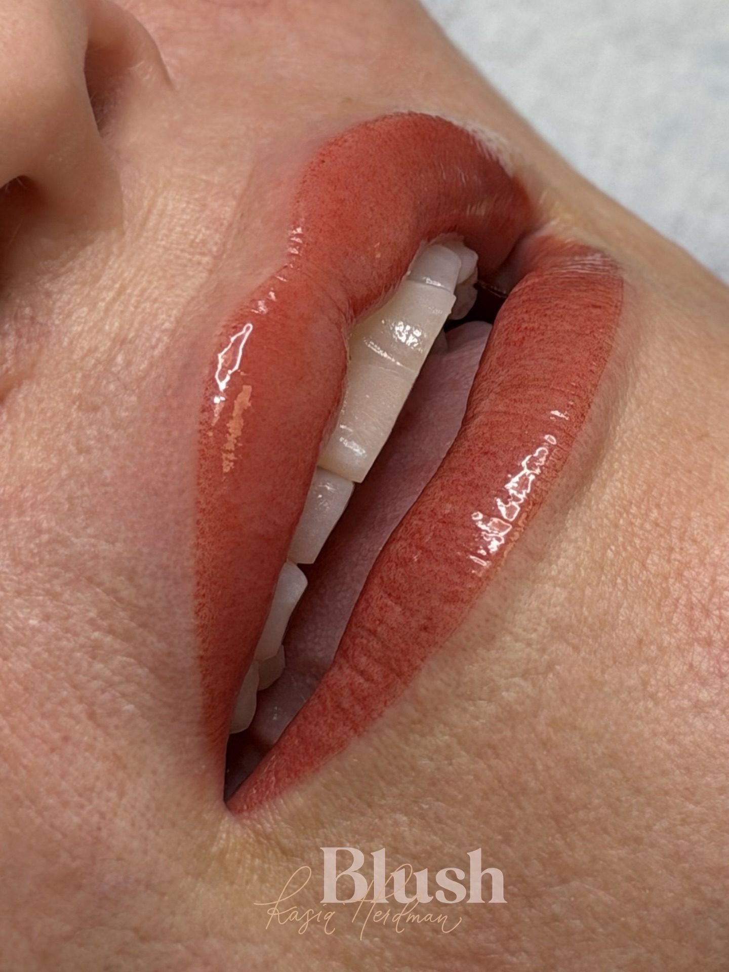 Lip blush is not just about color… it’s about structure + perception 💋
By softly extending pigment all the way to the natural edges of your lip tissue, we restore definition that gets lost over time. That crisp border creates contrast… and contrast is what makes lips appear fuller.
It’s not filler.
It’s not overlining.
It’s working with your anatomy to enhance what’s already there ✨
The result?
More symmetry.
More definition.
And that subtle illusion of naturally fuller lips 💖
This is where technique meets understanding of skin and color… and that’s what makes all the difference.
Schedule a lip blush consultation in my Acworth studio today!
#lipblushatlanta #lipblushacworth #acworthpmu #atlantapmu #kennesawpmu #woodstockgapmu #mariettapmu #cobbcountypmu #acworthga #kennesawga #woodstockga #mariettaga #atlantalips #lipblushartistatlanta #permanentmakeupatlanta #atlpmuartist #cobbbusiness #acworthbeauty #kennesawbeauty #woodstockbeauty