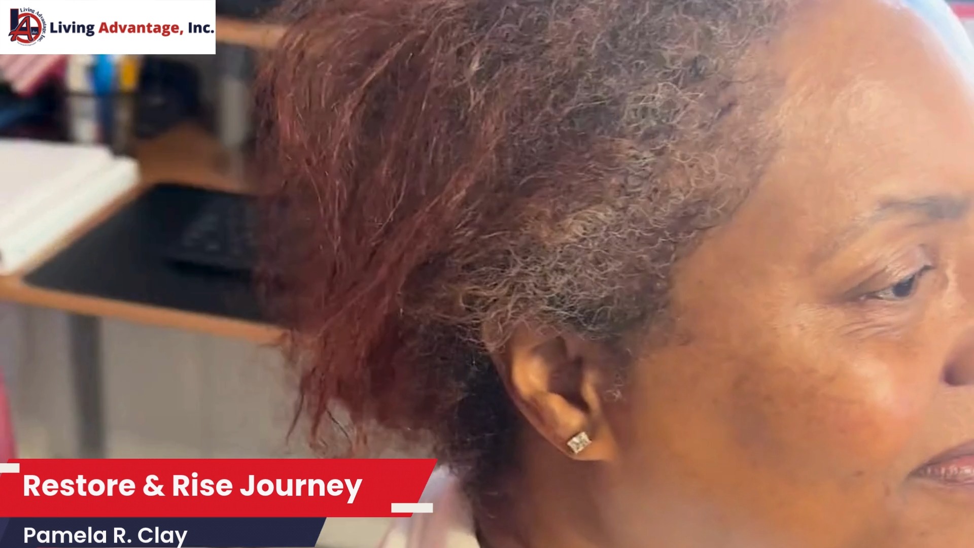 Week 1, Day 2
After 50+ years of coloring, heat, and damage… I’m starting over.
This journey is personal—but I’m sharing it for every woman who’s ever felt like it’s “too late” to take care of herself again.
A big thank you to @drsanusiumar and the team at @druhairandskin Clinic for guiding me through this process with so much care and expertise.
(And yes… he’s UCLA, I’m USC—but we’ll let that slide 😄)
At Living Advantage, we believe in restoration—in every form.
And this is mine.
Stay with me… this is just the beginning 💙
#Day1 #HairRestorationJourney #DrUmar #SelfCareJourney #WomensConfidence #LivingAdvantage #FosterYouthSupport #Restoration #LosAngeles #HealingJourney