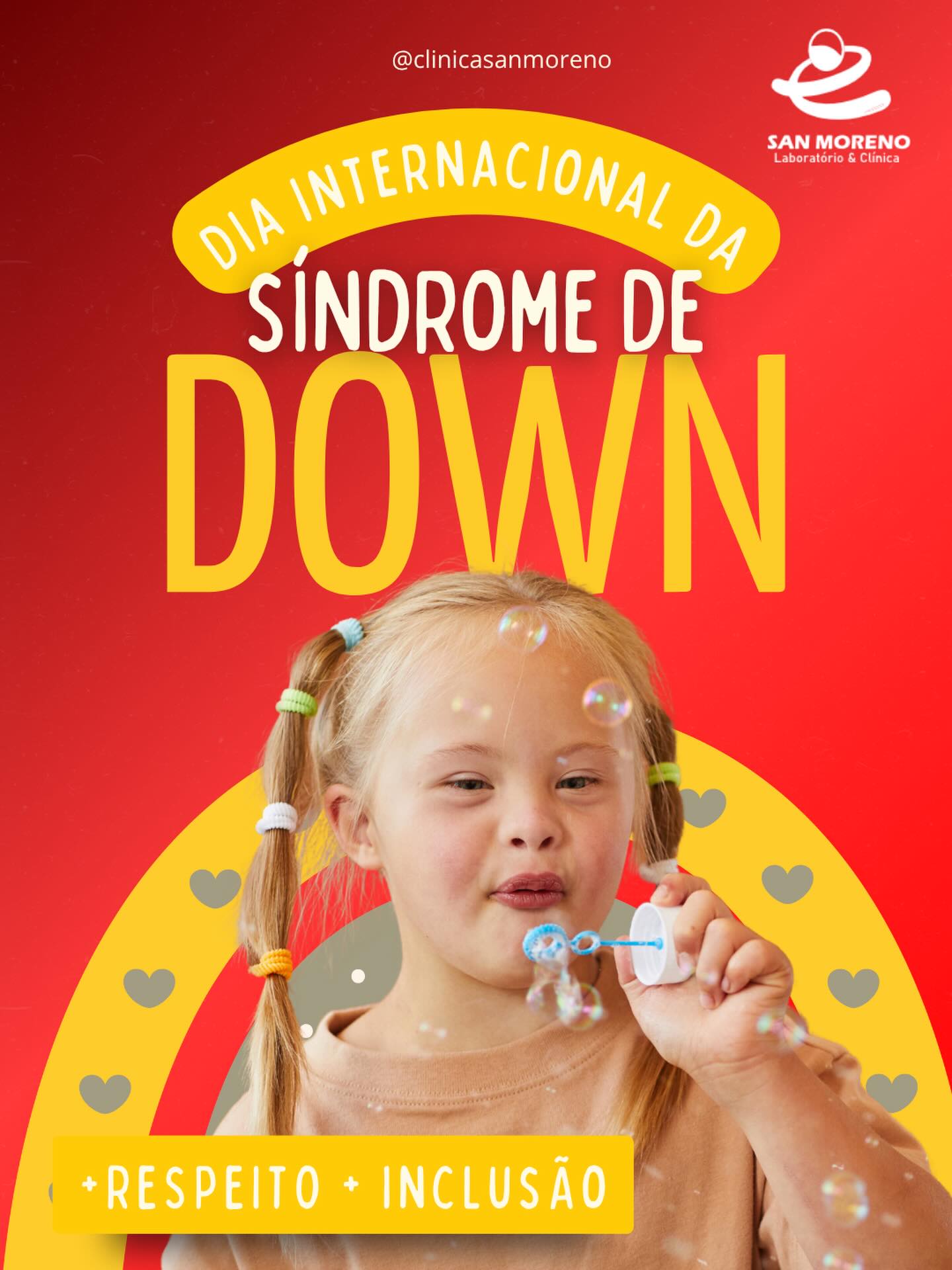 O Dia Internacional da Síndrome de Down, celebrado em 21 de março, é uma data dedicada à conscientização, inclusão e valorização das pessoas com síndrome de Down em todo o mundo. A escolha do dia 21/03 faz referência à trissomia do cromossomo 21, característica genética que define a condição.
Mais do que uma data simbólica, esse dia convida a sociedade a refletir sobre a importância do respeito às diferenças e da construção de um mundo mais inclusivo. Pessoas com síndrome de Down têm habilidades, sonhos e potencial como qualquer outra, e quando recebem oportunidades, apoio e acesso à educação e à saúde, podem desenvolver-se plenamente e contribuir de forma significativa para a sociedade.
A data também reforça o papel da família, da escola e das políticas públicas na promoção da igualdade de oportunidades. Combater o preconceito e a desinformação ainda é um desafio, e a conscientização é um passo essencial para mudar essa realidade.