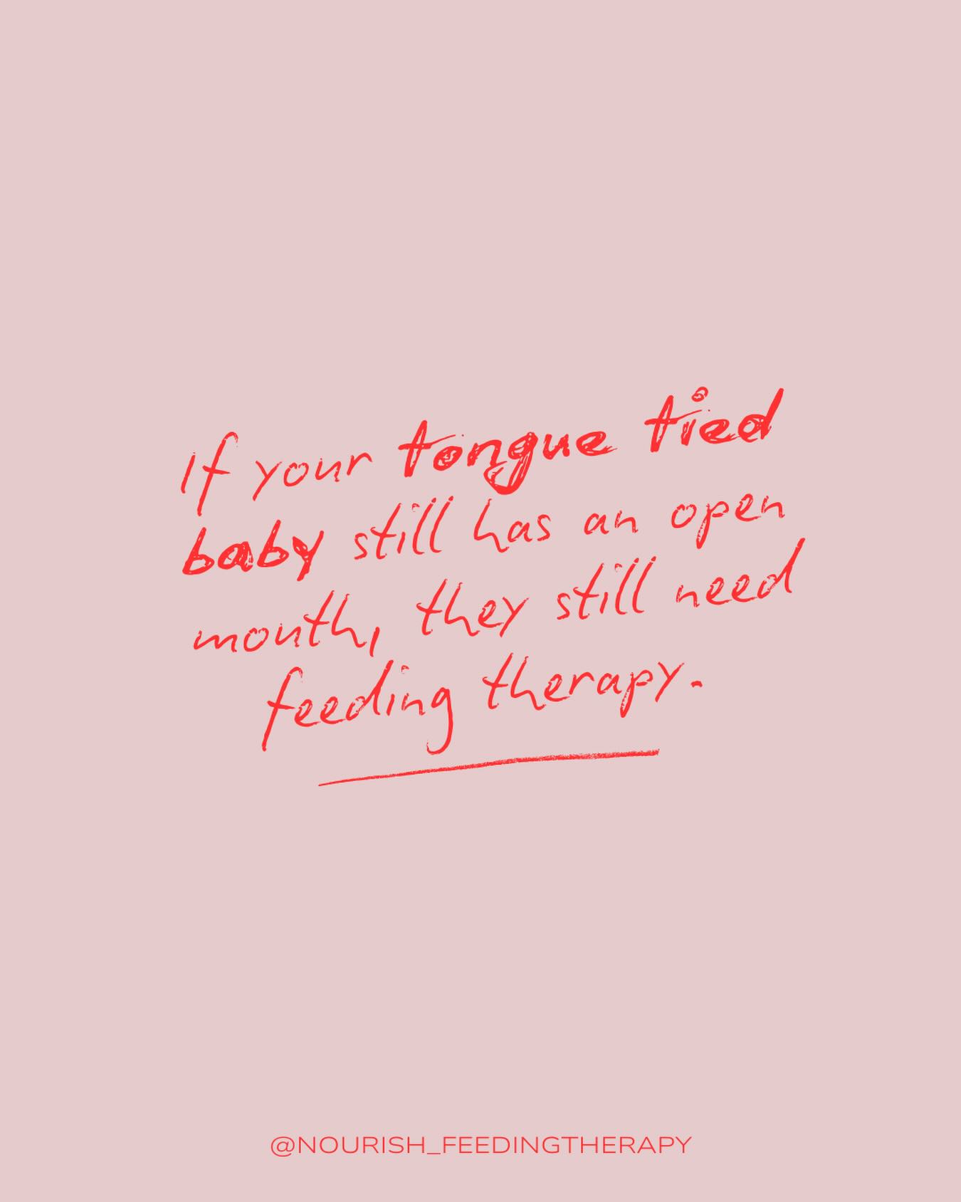 An open mouth posture isn’t just a phase — it’s the beginning stages of breathing dysfunction. And it shapes how your baby’s face, jaws, and airway develop.
Low tongue + open mouth = a recipe for:
• high, narrow palate
• smaller jaw growth
• crowded teeth later on
But more importantly… it impacts the airway space.
This pattern is strongly correlated to:
• chronic ear infections
• enlarged adenoids and tonsils
• sleep-disordered breathing
• tongue thrust swallow pattern (hello ortho relapse)
That tongue weakness could also impact picky eating and difficulty with speech sounds (talking takes a LOT of precise tongue movements in rapid succession)
This isn’t a small thing!
Our goal in feeding therapy isn’t just better feeds — it’s better function for development. We build tongue strength and coordination so the tongue can elevate and rest on the roof of the mouth, where it belongs.
Don’t stop at the release. Be sure your team includes a myofunctional trained speech-language pathologist or occupational therapist for long-term gains.