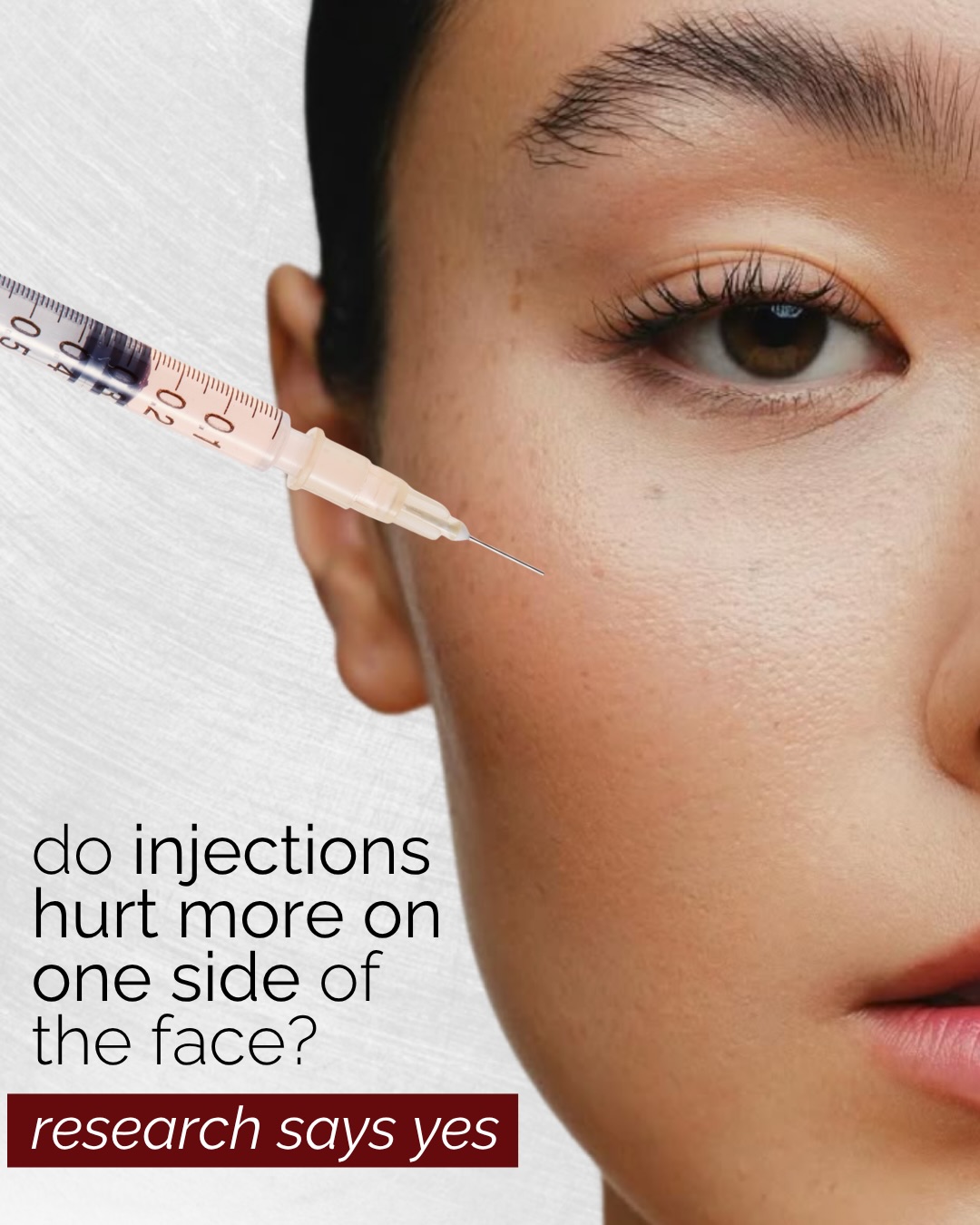 You’re not imagining it—one side of the face can feel more sensitive during injections.
Research suggests the left side of the face is often perceived as more painful, likely due to how the brain processes sensation. The right hemisphere (which processes the left side of the face) plays a stronger role in pain perception and emotional response, which can amplify how injections feel.
There are also natural differences in nerve sensitivity and facial asymmetry—so even with identical technique, each side can feel slightly different.
The good news?
Technique, needle choice, and treatment approach matter far more than side alone. A thoughtful, experienced injector can make treatments feel smooth, controlled, and very tolerable.
Because elevated results should come with an elevated experience.
—
Sources:
Khan et al., 2017
Recent clinical findings on facial pain perception (2025)