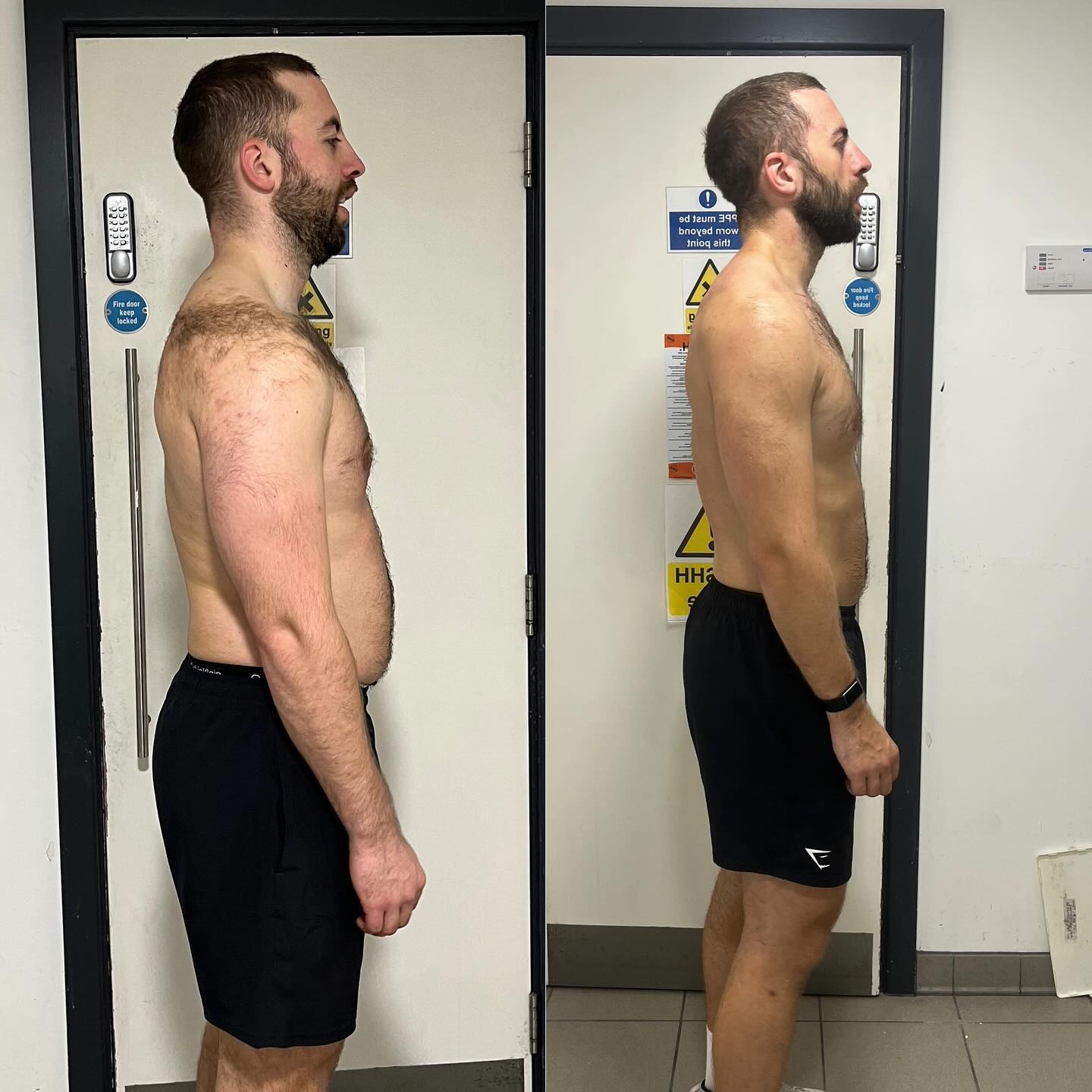 I already know what to do in the gym.
I just need to do it.
I don’t need a coach.
Meet Alex, a busy architect who said the same.
But Muffin tops over his jeans and shrinking confidence were drafting a different story.
Sound familiar?
It’s not about knowing what to do in the gym or stacking supplements.
Like Alex, you need a ‘who’ to guide you.
Someone to cut through the noise,
Someone to turn ‘enough is enough’ into your daily routine.
That’s where my Spring Shred Fat Loss Program comes in.
It’s your expert coach,
your accountability partner,
your blueprint to lose 15lbs in 10 weeks.
And see visible abs before summer.
Alex put his ego aside, and in 9 weeks, he shed 15lb without giving up his favourite food and refreshing beers.
Now, he’s more than just an architect.
He’s a master builder of his body and confidence.
Don’t let your mirror reflections be a question.
Make them an answer.
It’s time to commit to being your elite self –
For your family,
For your career,
And for you.
This week, I am looking for 5 serious people ready to lose 15lb before summer.
I’ll show you the workouts,
lay out the nutrition,
And give you the no-nonsense support you need.
Alex did it.
Now, it’s your turn to
Lose Fat
add muscle to your frame and strength to your resolve.
Ready to lose 15lb for good?
If you’re serious about losing 15lbs, it comes at a cost. (dollar) 💷
If you want to stay the same, then the cost is even higher (your health) 🤕
The only question is, how do you want to pay?
If you’re shouting “ME!” – Drop it in the comments OR slide into our DMs, and let’s Lose 15 lb before summer.
#transformation #bodytransformation #fatlosstransformation #summershredding #summershorts #summerbody #summergoals