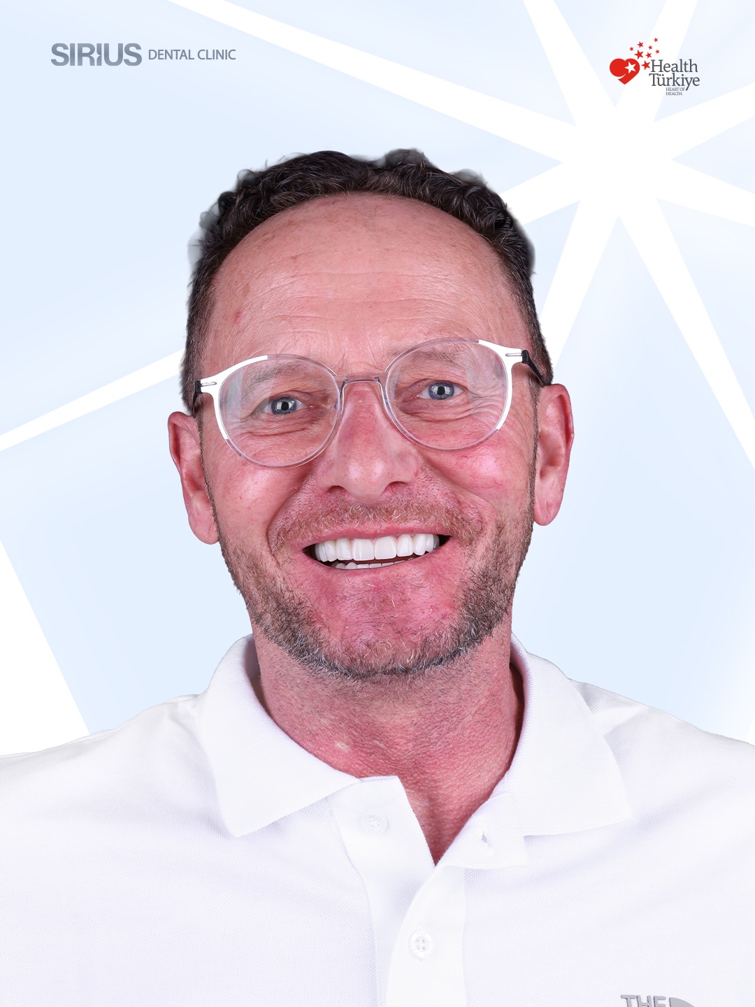 Dear our patient Holger’s smile journey reflects the transition from worn, compromised teeth to a naturally white and healthy smile.
A process shaped by personalised planning, meticulous execution, and a refined balance between oral health and aesthetics.
This reels captures how a smile is carefully redesigned step by step.
#siriusdentalclinic #zirconium #smileturkey #healthytourism #dentaltreatment