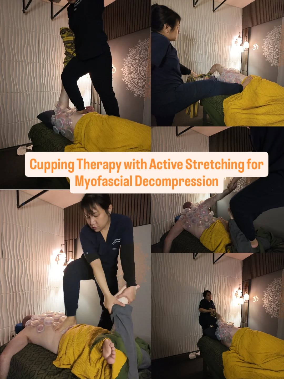 Combining cupping therapy with clients active stretching or therapist-led stretching for myofascial decompression. / is a highly effective, integrated approach to break down muscle knots, improve range of motion, and release stubborn fascial restrictions. The suction lifts tissues, creating a "sliding" effect that enhances the effectiveness of stretches to reduce pain, increase circulation, and boost athletic recovery.
Siam Bodyworks
619-876-8033
#CuppingTherapy
#sandiego
#thaimassage
#SportsMassage
#massagetherapist