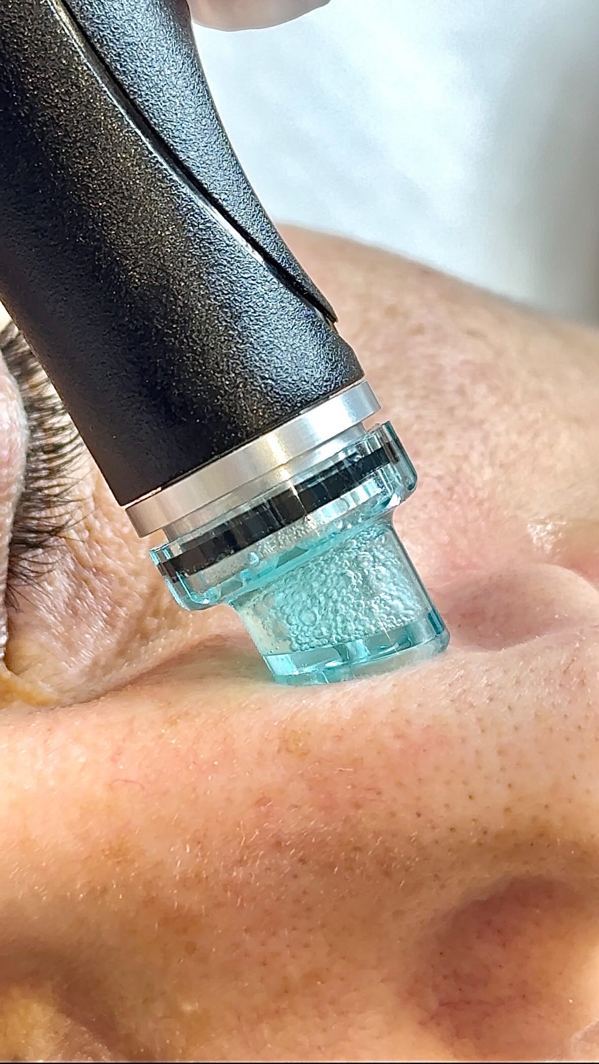 Deep clean, hydrate, glow — Hydrafacial is your skin’s best friend 💧
#hydrafacial #facial #beautyboxqatar #beautycare