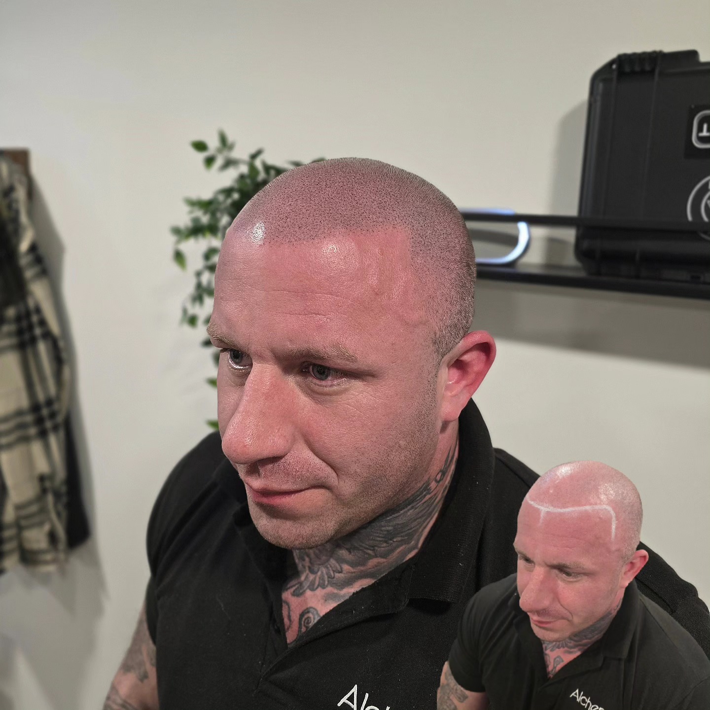 SMP TRANSFORMATION
Cosmetic tattooing for hair loss!
3 sessions later..
Natural hairline created!
Braved the shave!
Minimal to low maintenance!
No surgery or medication!
My client's pain rating was zero!! (Note:This is not the same for everyone!)
Enquire today to see how Scalp Micro-Pigmentation (SMP) can help end your hair loss insecurities!
📍Bury St Edmunds, Suffolk, UK
#hairtattoo #hair #cosmetictattoo #hairloss #menshair #scalpmicropigmentationtraining #scalpmicropigmentation #scalppigmentation #smp #scalptattoo #newhair #recedinghairline #balding #bald #buzzcut #shavedhead #barber #tattoo #artist ##hairlosssolution #rosemaryoil #finasteride #minoxidil #hairtransplant #pmu #spmu