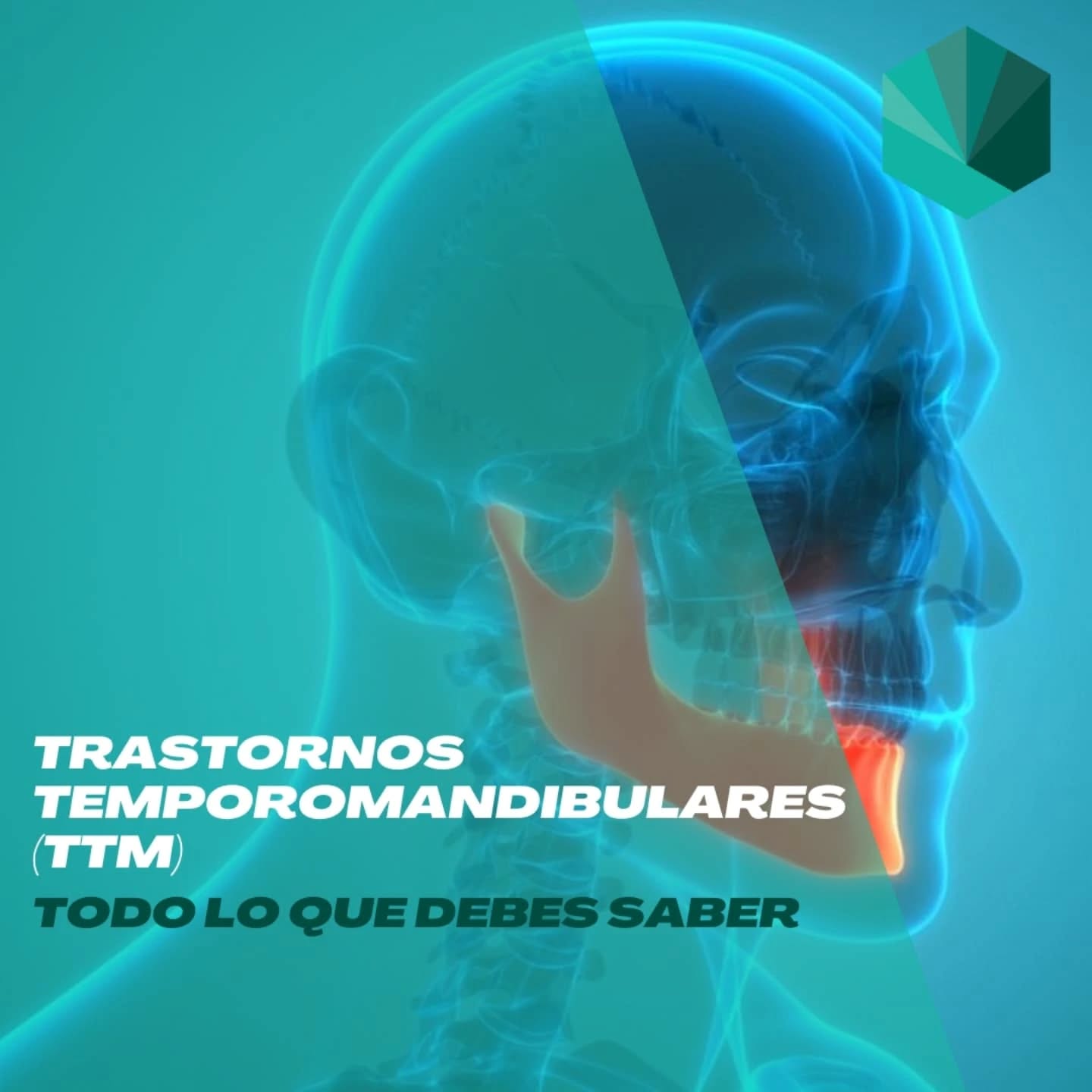 🥴Trastornos Temporomandibulares
🤔¿Sabías que nuestra mandíbula es una de las articulaciones más trabajadoras de nuestro cuerpo? A veces, puede que no le prestemos la atención que merece, pero los trastornos temporomandibulares (TTM) pueden hacer que esa pequeña parte de nosotros se sienta un poco abrumada.
🫨Desde el chasquido de la mandíbula hasta la sensación de tensión, estos trastornos pueden afectar nuestro día a día. Pero no te preocupes, ¡hay formas de cuidar de ella!
💚 En ValTem fisioterapia trabajamos para resolver tu dolor y mejor tu calidad de vida
