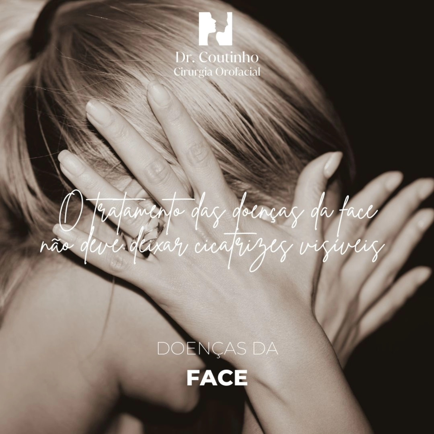 ✨ Hoje partilhamos um caso de resseção cirúrgica de uma malformação venosa no espaço bucal, realizado com sucesso através de uma abordagem transoral.
Esta técnica permite tratar a lesão sem incisões visíveis no rosto, preservando a aparência natural e evitando cicatrizes. A saúde, a confiança e a autoestima dos nossos pacientes são a nossa prioridade, e por isso, procuramos sempre as melhores técnicas para garantir um resultado estético impecável. 😊
Cada caso é avaliado com cuidado para assegurar o melhor resultado funcional e estético. 🌟
Agende uma avaliação e saiba mais sobre os nossos tratamentos minimamente invasivos.
#CirurgiaDaFace #MalformaçõesVasculares #SimetriaFacial #Estética #AbordagemTransoral #Autoestima