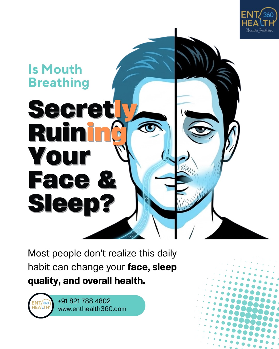 Is the puffiness of my face also because of mouth breathing?
Yes. Poor oxygenation and disturbed sleep often cause facial puffiness, particularly around the eyes. Over time, chronic mouth breathing can lead to permanent structural changes known as Adenoid Facies (or Long Face Syndrome).
Why do I wake up tired even after sleeping 7–8 hours?
Waking up exhausted is often a direct result of mouth breathing. This habit reduces oxygen intake and causes “micro-awakenings” that ruin your sleep quality. Over time, it leads to Adenoid Facies—a condition where the face becomes long and narrow, the jawline weakens, and the chin recedes because the tongue isn’t resting against the palate to support facial growth.
Mouth Breathing: Causes, Symptoms, and Treatment
Mouth breathing is a common condition affecting both adults and children. It is strongly linked to snoring, sleep disturbances, sinus issues, and facial changes.
Common Symptoms:
* Snoring
* Frequent waking
* Daytime fatigue
* Dry mouth and bad breath
* Recurrent infections
Facial Changes (Adenoid Facies):
* Long, narrow face
* Weak jawline
* Receding chin
* Dental crowding
Common Causes:
* Deviated septum
* Enlarged adenoids or tonsils
* Allergies
* Chronic sinus problems
If you have snoring, blocked nose, or poor sleep, it may be due to a nasal airway issue.
Dr. Prashanth R. Reddy specializes in treating mouth breathing, sinus issues, and sleep-related breathing problems.
Treatment options include:
* Allergy management
* Lifestyle changes
* Tonsil/adenoid treatment
* Nasal airway correction
📍 Serving Patients Across Bangalore
Patients visit from across Bangalore, including:
HSR Layout
Koramangala
Sarjapur Road
Bellandur
BTM Layout
Indiranagar
Whitefield
Electronic City
Marathahalli
Outer Ring Road (ORR)
Breath Better. Sleep Better. Live Better.
📞 👉 Whatsapp or Contact: +91 821 788 4802
👨⚕️ Dr. Prashanth R. Reddy
ENT & Endoscopic Sinus Surgeon
📍 HSR Layout
🕐 11:00 – 13:00 (Mon–Sat)
🕐 14:00 – 16:00 (Mon–Sat)
📍 Koramangala
🕐 17:00 – 19:00 (Mon–Sat)
🕐 11:00 – 13:00 (Sunday)
#MouthBreathing #ENTDoctorBangalore #SnoringTreatment #SinusCare #SleepHealth