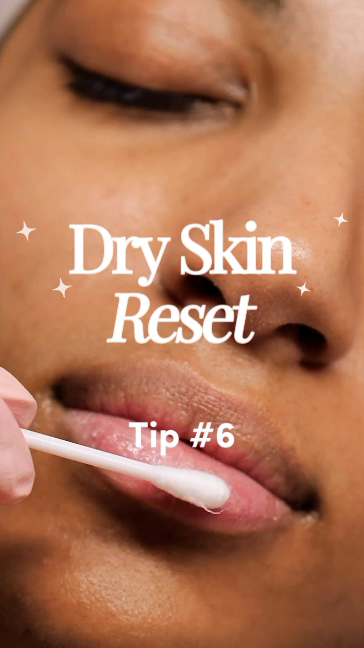 Want to know why your lips and hands are so dry? Read this. 👇
Hands and lips are usually the first to feel dry… and the hardest to keep moisturized.
Here’s why:
- Your lips have no oil glands, so they can’t naturally keep themselves moisturized.
- Your hands (especially your palms) have fewer oil glands and are constantly exposed to washing, cold air, and friction throughout the day.
Here’s how to give them the extra support they need:
1. After every hand wash, reapply your hand cream.
Water + soap strip your natural oils, and without replenishing them, dryness builds up quickly.
2. At night, switch to repair mode.
Use a thicker, more emollient hand cream and wear 100% cotton gloves while you sleep.
This helps lock in moisture and gives your skin time to recover.
3. Don’t forget your lips.
Layer your hydrating face serum underneath your lip balm to keep them moisturized longer.
Dry, cracked hands and lips aren’t just seasonal.
They’re a sign your barrier needs more support.
Follow along for the next step in your Dry Skin Reset.
#dryskintips #dryskinreset #northyorkskinclinic #torontowinter #medispa