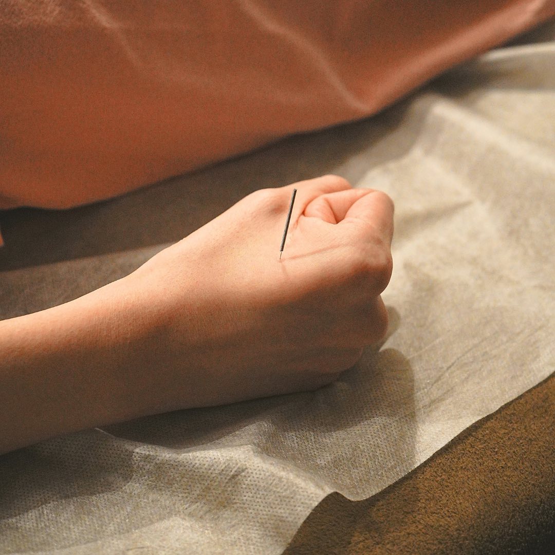 Feeling stressed, battling aches, or struggling with sleep? Acupuncture offers natural relief by restoring balance and releasing tension.
🌿 How it helps:
Eases stress and anxiety
Relieves pain and stiffness
Improves sleep quality
Reconnect with your body’s natural healing power. 💆♀
📍 Visit us to experience the benefits of acupuncture!
#AcupunctureHealing #NaturalTherapy #HolisticHealth #TCM #WellnessJourney #ChineseMassage #TraditionalTherapy #Relaxation #LondonWellness #HolbornMassage #StressRelief #Rejuvenation #BodyAndMindBalance