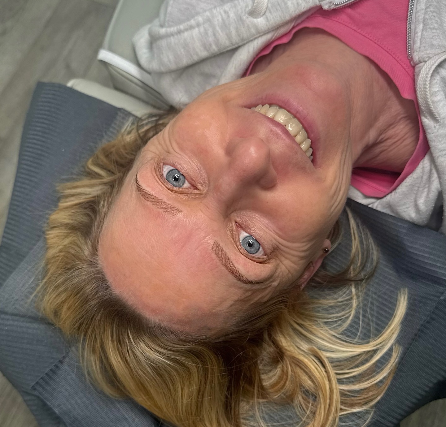 Swipe ➡️ right to see the before!
This just shows how transformative brows can actually be! This beautiful lady wanted brows that could be there for her weekly swimming, without having to worry about them disappearing! She had sparse, fair brows that she felt were barely there, and wanted some lovely new brows to frame her face, and give her the confidence she deserves!
In under 90 minutes and minimal pain, she now has brows she has always dreamed of having! I absolutely loved creating these brows, and she wishes she did this sooner! A very happy client once again ♥️
#brows #eyebrowtransformation #pmu #chichester #semipermanentmakeup