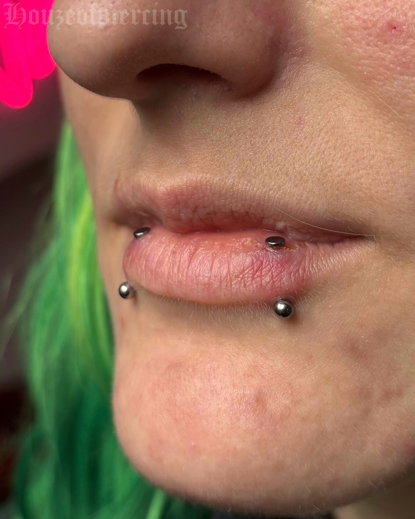 An update on these paired vertical labrets! Downsized for a a comfortable fit and a great representation for how healing can go.
Are they a little red? Yup. Are they a little inflamed? Absolutely. Completely normal to experience, especially when piercings are only 4 weeks old! Nothing is ever going to be completely perfect when healing piercings. Patience and care are the most imporant things you can do, along with not fucking touching it 🙂↕️🙂↕️
Anyway, more of these pleeeeeease 🖤
🖤 @venusinfurs.ie 14 Exchequer St, Dublin 2
⛓️ Tuesday to Saturday, booking link in bio
#piercing #piercer #lippiercing #verticallabret #dublin