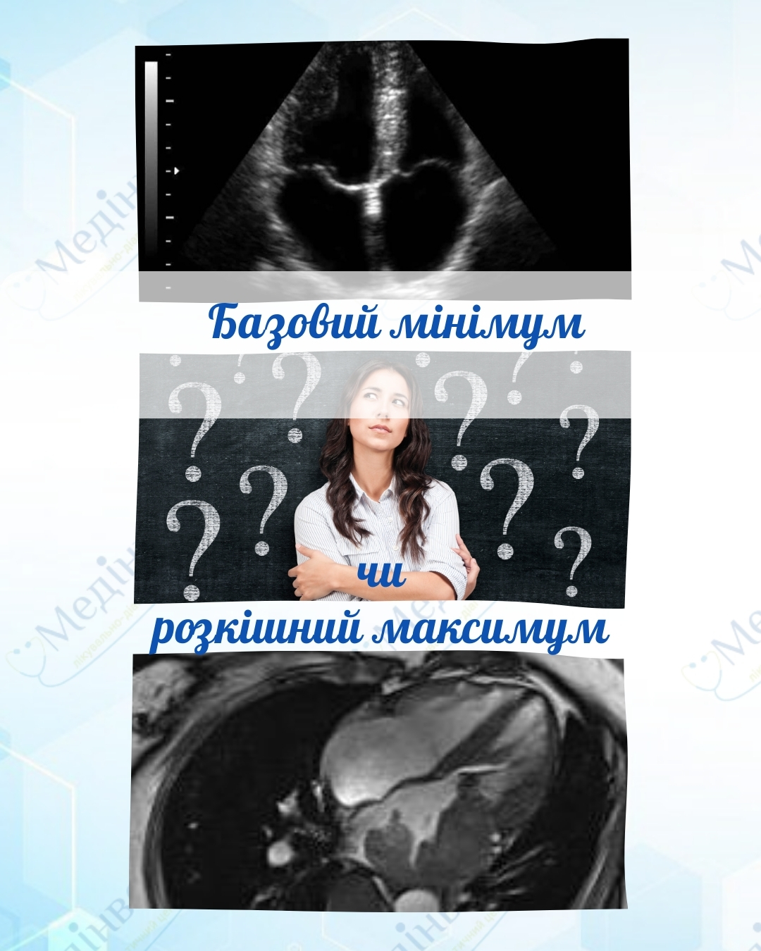 ❤️ Ехокардіоскопія та МРТ серця — мінімум чи максимум?
Коли йдеться про діагностику серця, пацієнти часто запитують:
чи достатньо одного обстеження, чи потрібно більше?
Відповідь проста:
це не “або-або”, а різні методи з різними завданнями.
🩺 Ехокардіоскопія (УЗД серця)
Це базове і обов’язкове дослідження в кардіології.
ЕхоКГ дозволяє оцінити:
✔️ розміри камер серця,
✔️ скоротливу функцію,
✔️ стан клапанів,
✔️ наявність рідини,
✔️ загальну гемодинаміку.
Саме з ехокардіоскопії починається обстеження серця у більшості випадків.
🧲 МРТ серця
Це поглиблений метод, який застосовується за показами.
МРТ серця дозволяє:
✔️ детально оцінити структуру міокарда,
✔️ виявити рубцеві або запальні зміни,
✔️ уточнити вроджені аномалії,
✔️ оцінити тканинні характеристики серця.
МРТ не замінює ехокардіоскопію,
а доповнює її, коли потрібна більша точність.
📌 То що ж це насправді?
✔️ ЕхоКГ — базовий мінімум,
✔️ МРТ серця — обґрунтований максимум,
який застосовується не всім, а тоді, коли це дійсно необхідно.
Правильну тактику обирає кардіолог,
враховуючи симптоми, результати ЕКГ, УЗД та анамнез.
У "МедІнвест" ми дотримуємось принципу:
не більше, ніж потрібно — але рівно стільки, скільки необхідно для точної діагностики.