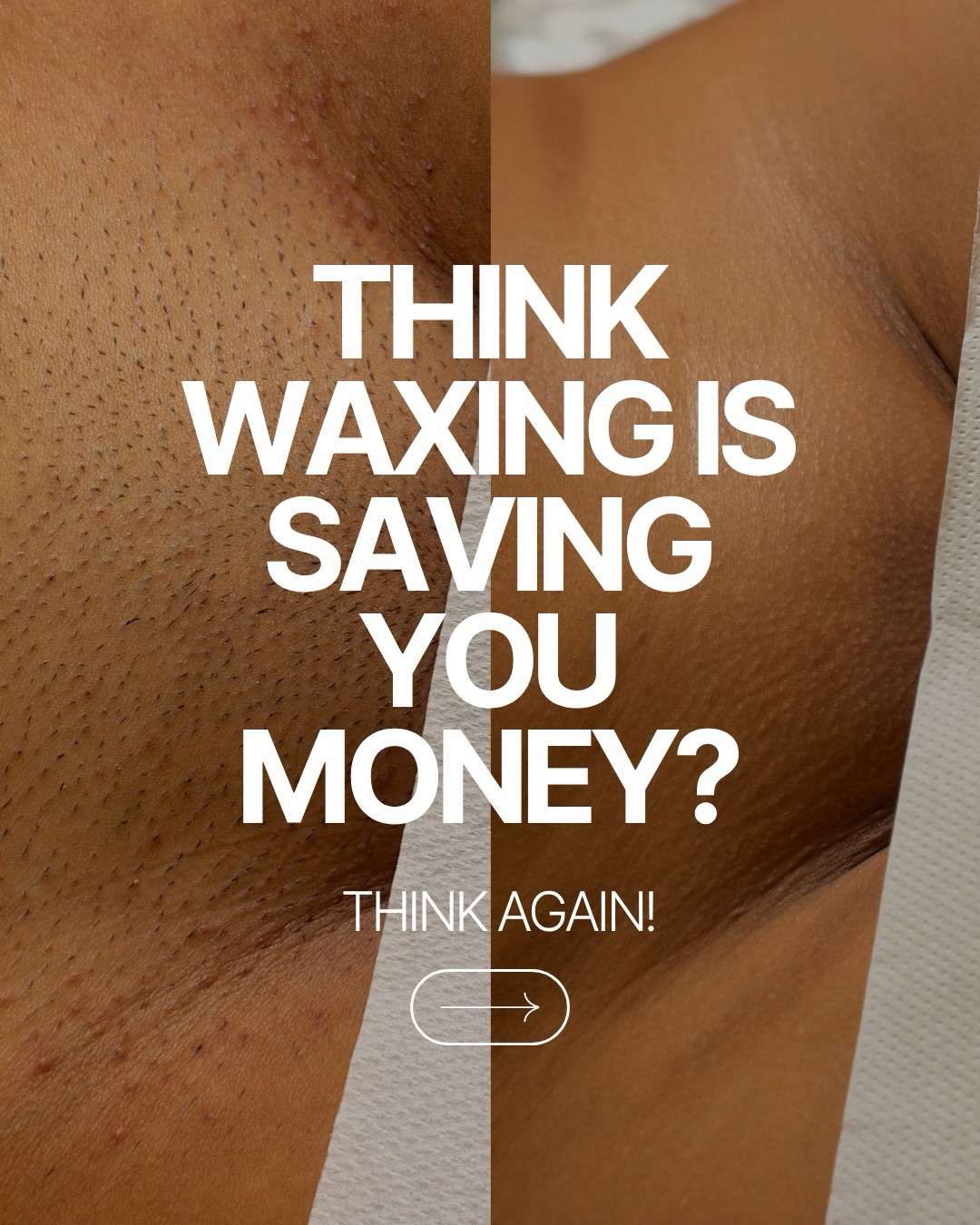 Ditch the razor 🪒
Ditch the waxing 🌳
Ditch the stubble 😳
BOOK YOUR LASER 🐬