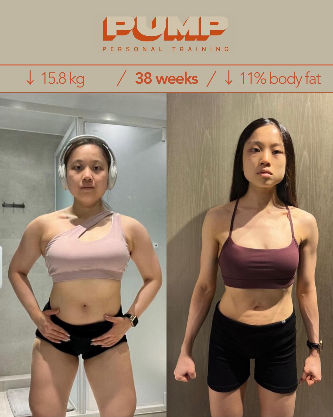 For Isabella, this journey was never just about the number on the scale. It was about discovering her own strength and building a powerful foundation. Over time, she added more than 15kg of muscle, transforming her body and stepping confidently onto the stage at 11% body fat.
對 Isabella 嚟講,呢段旅程從來唔係追求體重數字,而係發掘內在力量,並為自己建立一個強大嘅根基。透過 38 星期嘅堅持,佢成功增肌超過 15kg,徹底重塑體態,最終以 11% 體脂嘅巔峰狀態,自信咁踏上比堅尼比賽舞台。
🔸 𝗙𝗿𝗼𝗻𝘁 正面 🔸
Her once slender frame now radiates athletic balance. You can see her hard work in her defined core and the confident lines of her midsection. With stronger shoulders and quads, Isabella has shaped the classic bikini silhouette, and her features glow with new energy.
曾經纖弱嘅身型,依家散發住一種健康嘅平衡美,從清晰嘅腹肌線條,可以見到佢背後付出咗幾多汗水。肩膀同股四頭肌嘅肌肉量增加,令 Isabella 擁有咗比堅尼運動員最經典嘅 S-Curve 輪廓,全個人望落去充滿活力。
🔸 𝗕𝗮𝗰𝗸 背面 🔸
The transformation from the back is truly inspiring. Isabella’s upper back is now strong and defined, her shoulders broader and tapering down to a trim, athletic waist. This powerful V-shape is a testament to her dedication and the resilience she’s built over 38 weeks.
背面嘅轉變真正體現到咩叫毅力,Isabella 嘅上背部依家變得強而有力,線條分明;肩膀線條橫向發展,完美修飾出緊緻嘅腰線。
🔸 𝗦𝗶𝗱𝗲 側面 🔸
You can see Isabella’s confidence in the way she stands: tall, proud, and strong. Her posture is open, her midsection steady, and her arms show the results of her commitment. Her profile now radiates balance and strength.
從側面睇,你可以感受到 Isabella 嗰份由內而外嘅自信:企得更挺拔、更從容。佢嘅體態唔再係單薄,而係一種充滿核心力量嘅紮實感,展示出力量同美感嘅結合。
𝗣𝗨𝗠𝗣 𝗧𝗿𝗮𝗻𝘀𝗳𝗼𝗿𝗺𝗮𝘁𝗶𝗼𝗻
This transformation is what happens when you stop focusing on the scale and start focusing on your own strength. Isabella’s journey with the PUMP system shows that real change is about more than just appearance; it’s about standing tall and letting your confidence shine.
當你唔再執著於體重,轉而專注於鍛煉力量,就會發生好似 Isabella 咁樣嘅transformation。PUMP 嘅專業系統證明咗,真正嘅改變唔止係外觀,而係當你學會擁抱力量,嗰份自信係會由內到外滲透出出嚟。
𝗔𝗖𝗧 𝗡𝗢𝗪 立即行動
Are you ready to move beyond chasing ‘skinny’ and start building your own strength? Book a free consultation through the link in our bio and take the first step toward discovering what beauty means for you.
你準備好跳出「盲目追求瘦」嘅框框未?立即開始建立屬於你嘅力量,透過 Bio 連結預約免費諮詢,重新定義屬於你嘅美。