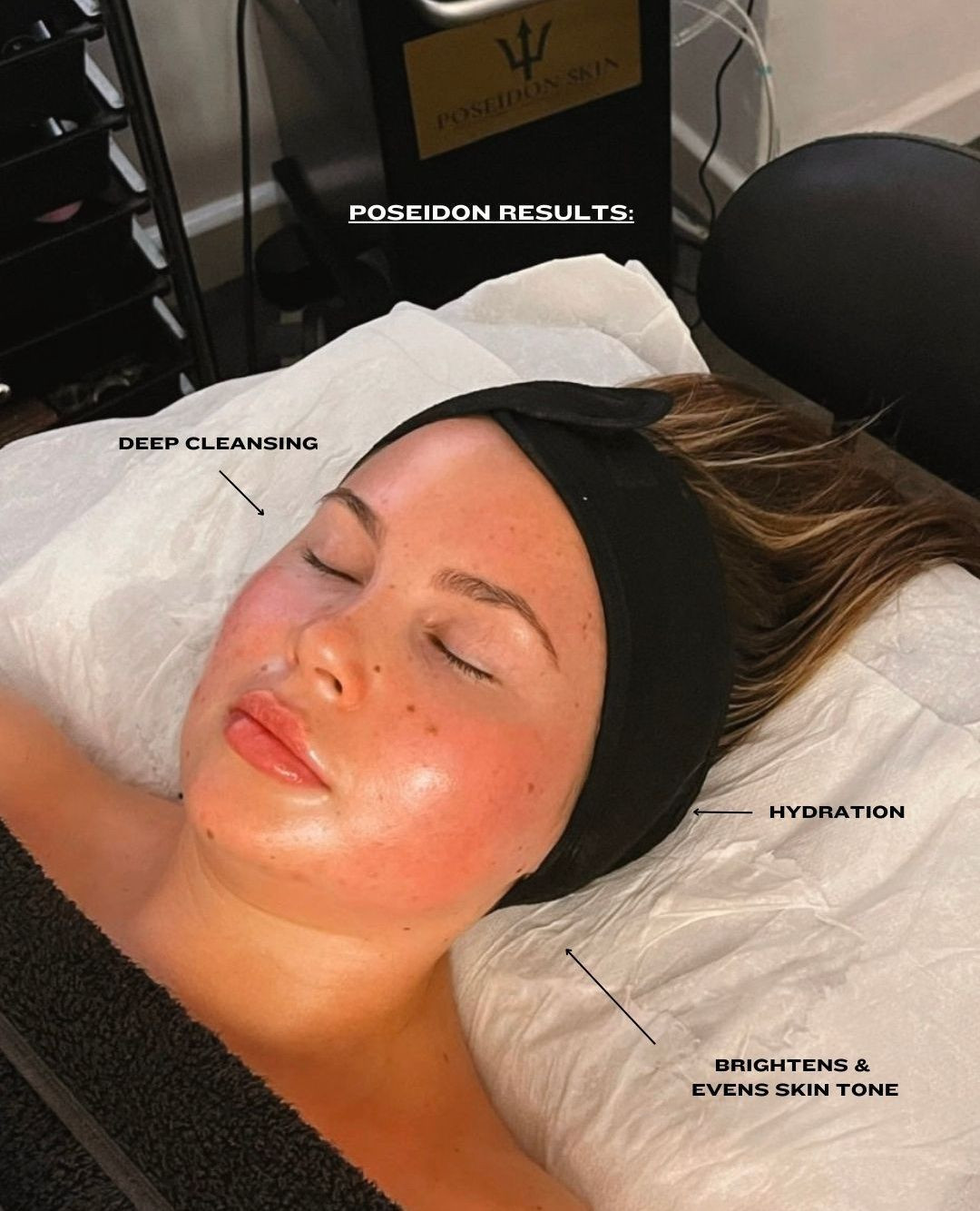 Skin so fresh, it glows ✨
The results from the Poseidon HydraDermabrasion machine are truly next level! Transform your skincare game and elevate your business. Get in touch to discover the benefits—not just for your clients, but for you as an entrepreneur too.
#HydraDermabrasion #SkinGlow #FreshSkin #NextLevelSkincare #EntrepreneurLife #BeautyInnovation #SkinCareBusiness #GlowingSkinGoals