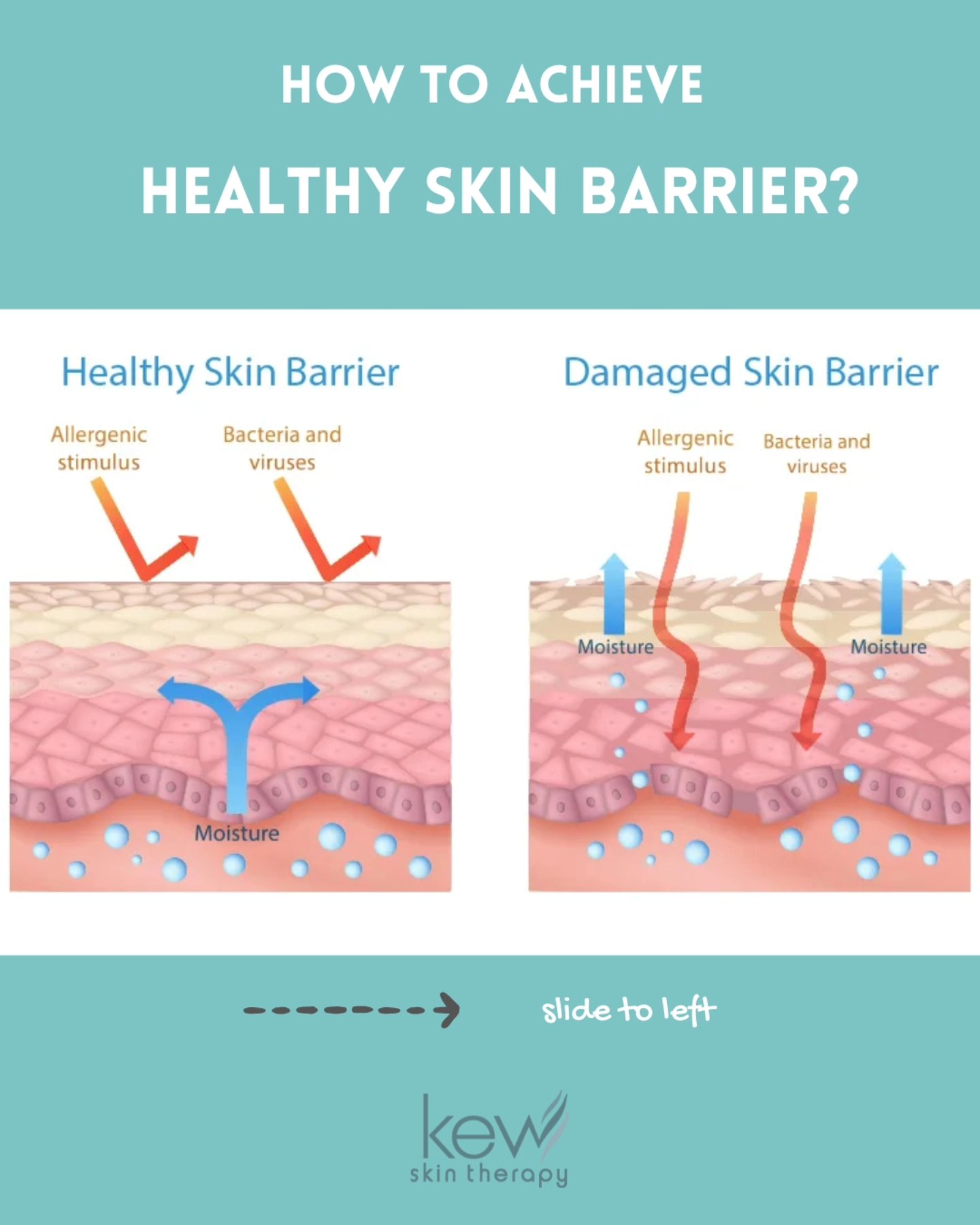 Your skin barrier is your first line of defense — keeping moisture in and irritants out. When it's healthy, your skin looks radiant, feels smooth, and stays resilient. When it's compromised, dryness, sensitivity, and breakouts can creep in.
Protect it. Nourish it. Strengthen it. Healthy skin starts with a strong barrier.
#SkinBarrier #HealthySkin #GlowingSkin #SkincareTips #BarrierCare #Kewskintherapy