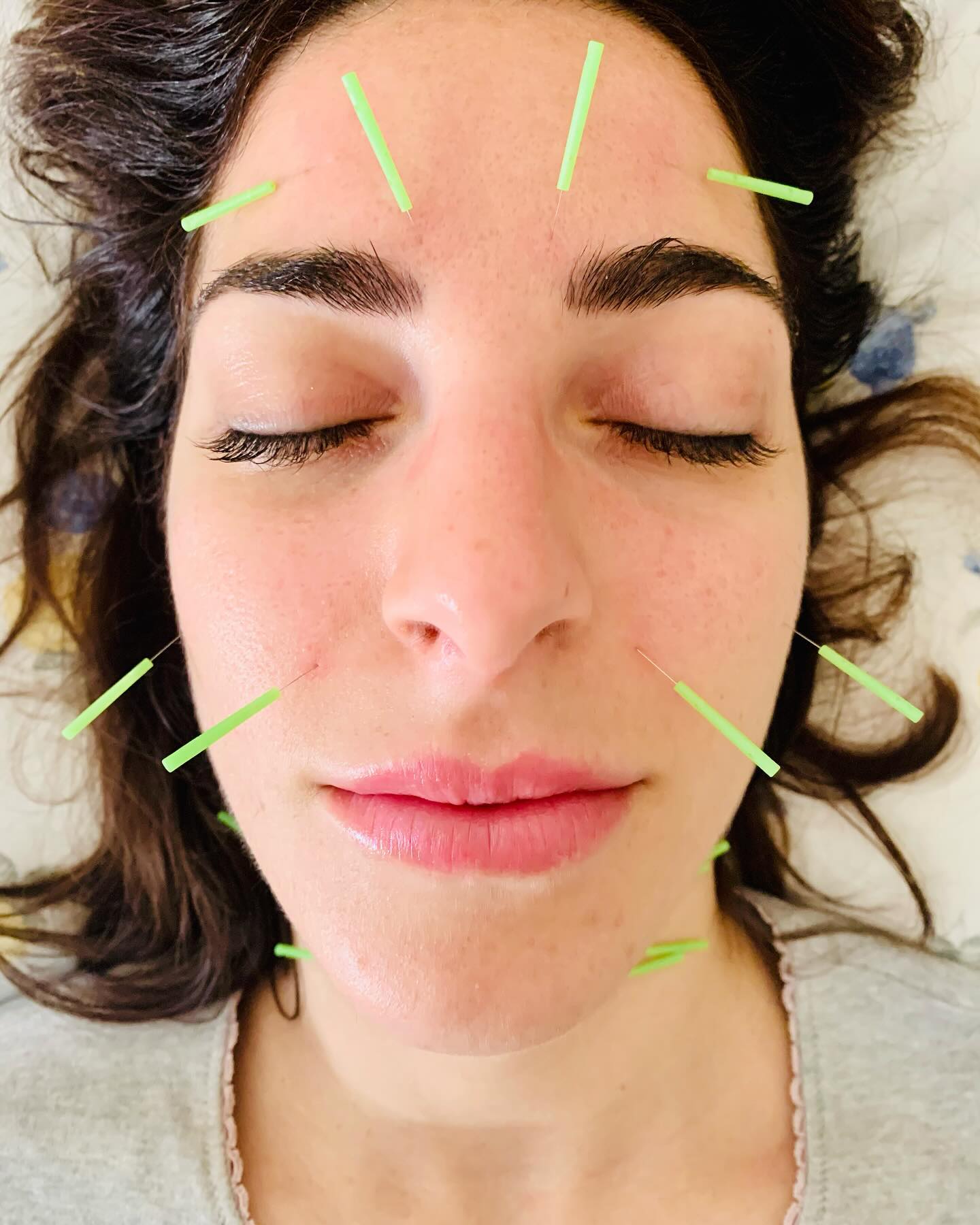 Cosa significa la bellezza?
Nelle culture orientali, la bellezza equivale all’equilibrio e l’equilibrio inizia dall’interno.
La tua storia è scritta sul tuo viso e riflette ciò che sta accadendo all’interno del tuo corpo, come funzionano i tuoi organi e lo stato della circolazione sanguina e linfatica.
In un trattamento di ringiovanimento con la Medicina Cinese, si utilizzano potenti punti energetici, sia sul viso che sul corpo.
In questo modo si tratta non solo l’aspetto del viso sennò anche gli squilibri interni, per disintossicare le cellule, aumentare l’energia disponibile agli organi e migliorare la cute da dentro.
Quali sono i benefici dei trattamenti estetici?
Alcuni dei benefici riportati includono:
* Pelle più luminoso
* Stimolazione della produzione di collagene
* Miglioramento dell’equilibrio ormonale
* Riduzione dell’acne
* Pori minimizzati
* Riduzione dell’aspetto delle linee sottili e delle rughe
* Riduzione del gonfiore e del rigonfiamento del viso
* Miglior tono muscolare del viso
* Riduzione della tensione mandibolare
* Riduzione del cedimento della pelle
* Miglioramento del sonno, l’umore e la digestione
Quante sessioni mi serviranno?
Il trattamento estetico, che consiste in diverse tecniche di stimolazione per riportare la vitalità sia alle pelle che al corpo, è come portare il tuo viso in palestra.
I cambiamenti avvengono nel tempo e devono essere mantenuti. Proprio come non puoi ottenere muscoli come Braccio di Ferro dopo una sola sessione in palestra, di solito è necessario un minimo di 6-8 sessioni settimanali, ma idealmente 10-12 sessioni per creare dei risultati duraturi. I trattamenti possono anche essere effettuati due volte alla settimana per ottenere risultati più rapidi.
Se ti interessa sapere come tu puoi ringiovanire la tua pelle in modo sicuro e naturale, mandami un DM per una consulenza gratuita.
Alla vostra salute e bellezza!
Teressa @joyfulheartacuwellness
#ringiovanimentonaturale #trattamentiestetici #medicinatradizionalecinese #digitopressioneviso #guarigionenaturale #trattamentiolisticiroma #riflessologiafacciale #chinesemedicinerome