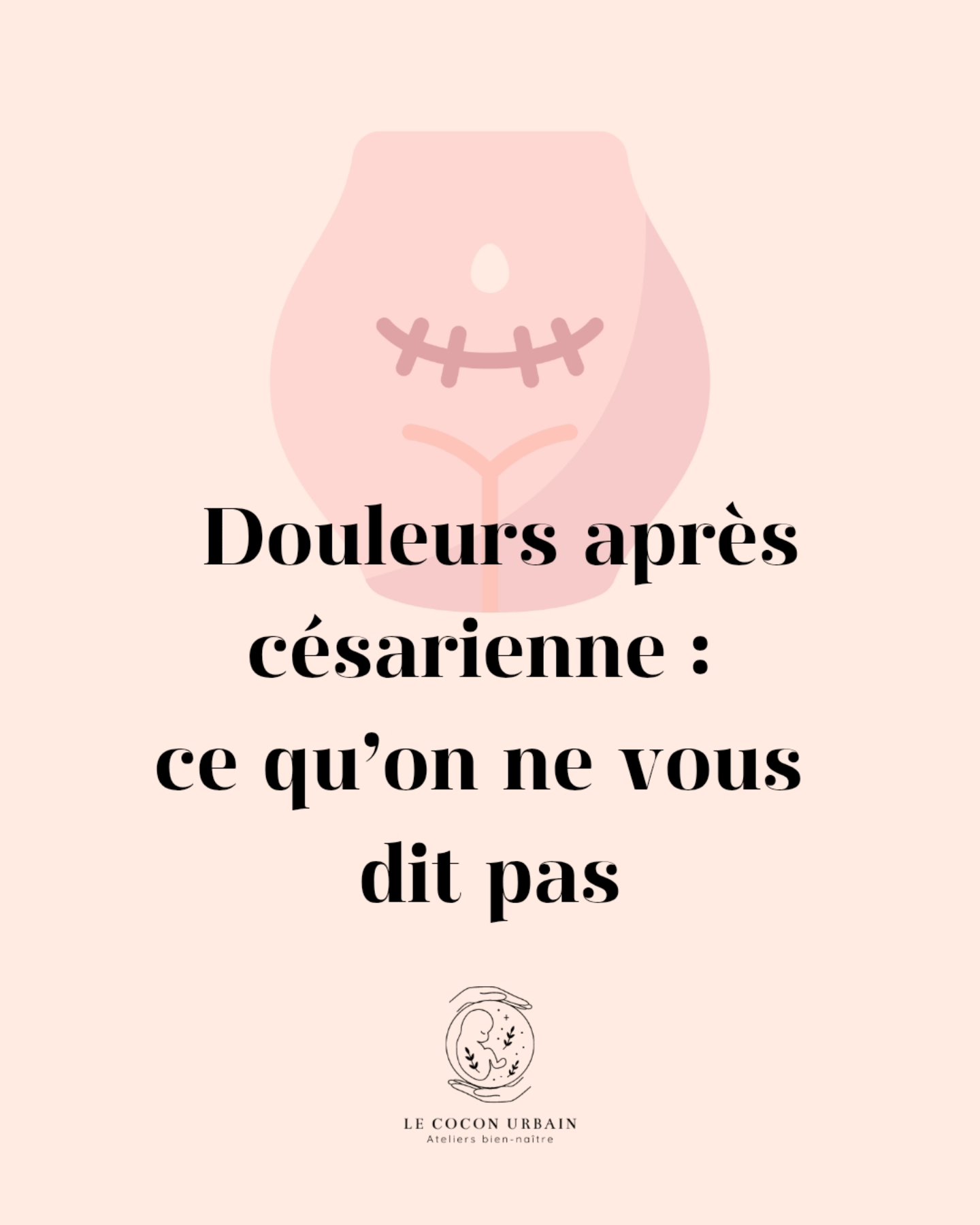 💬 Est-ce que tu le savais ?
🌀 Douleurs après césarienne : et si c'était la rachi-anesthésie ?
Chaque naissance est unique… et chaque corps aussi. Beaucoup de jeunes mamans ressentent des douleurs après l’accouchement, mais saviez-vous que les douleurs après une césarienne ne sont pas du tout les mêmes que celles d’un accouchement par voie basse ? 💫
➡️ Après une césarienne avec rachi-anesthésie, certaines femmes souffrent de :
Migraines intenses, souvent appelées céphalées post-rachidiennes,
Douleurs lombaires, parfois sourdes, parfois très localisées,
Une sensation de fragilité dans le dos, comme si la colonne avait perdu de sa force.
🎯 Ces douleurs ne viennent pas de l’utérus ou de la cicatrice… mais du point d’injection dans la colonne vertébrale. La rachi-anesthésie peut parfois perturber l’équilibre des tissus profonds, ou créer une tension résiduelle autour de la zone lombaire et sacrée.
🌿 Un accompagnement adapté (massages postnataux, mobilisation douce, respiration, repos) peut soulager efficacement ces symptômes.
🤍 À toutes les mamans qui vivent ces douleurs : vous n’êtes pas seules. Écoutez votre corps. Demandez du soutien. Et rappelez-vous que prendre soin de vous, c’est aussi prendre soin de votre bébé.
#PostPartum #Césarienne #Rachianesthésie #MamanEtBébé #MassagePostNatal #CoconUrbain #Accouchement #grossesse #maman #bebe #parentalite #maternité #monpostpartum