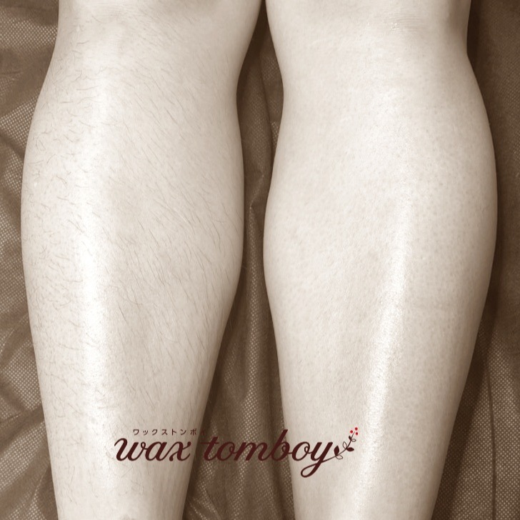 【そろそろひざ下を出す季節です】
こんにちは!
さいたま市浦和区のワックス脱毛専門プライベートサロン&スクールのワックストンボイです。
だいぶ暖かくなってきて薄着になる機会も増えました。
お肌が出る季節に備えてムダ毛をしっかり処理しておきましょう~♪
先日ひざ下のオーダーをいただいたお客様☆
向かって左側がワックスする前
ワックス後のお肌は古い角質が毛と一緒に除去されているので、お肌の色もワントーンアップします☆
そして保湿剤も入りやすいので、しっかり保湿してあげることで、つるんつるんでふわふわ触感のお肌の出来上がり☆
ぜひ一度お試しください(^^♪
ご予約はプロフィールのホットペッパーURL、または「ワックストンボイ」で検索よりどうぞ!
◆ワックススクール◆
✢未経験から開業を目指す方
→皮膚の構造や毛周期などの基礎からプロとして通用する技術まで徹底的に
✢技術者向け講習
→VIOが30分で終らない、ハードワックスの使い方に不安がある、ストリップワックスが苦手etc. 施術時間のスピードアップ、苦手部位の技術向上、今さら聞けない基本など。
マンツーマンでしっかり徹底的に学べます。
私も未だにそうですが、私より先輩ワクサーの方々も勉強会などで技術力と知識力の向上を常に目指しています。
1つのスクールを受講したから満足ではなく、少しでもお客様に快適と感じて頂ける施術方法を一緒に追求しませんか?
楽しいですよ😊❣️
DMでお気軽にお問合せください。
■■■■■■■■■■■■■■■■■■
Wax Tomboy(トンボイ)
9am-7pm
さいたま市浦和区仲町3丁目
浦和駅北口より徒歩8分
駐輪場あり、近隣コインパーキング有
■■■■■■■■■■■■■■■■■■
#角質ケア
#ワックス脱毛
#ブラジリアンワックス