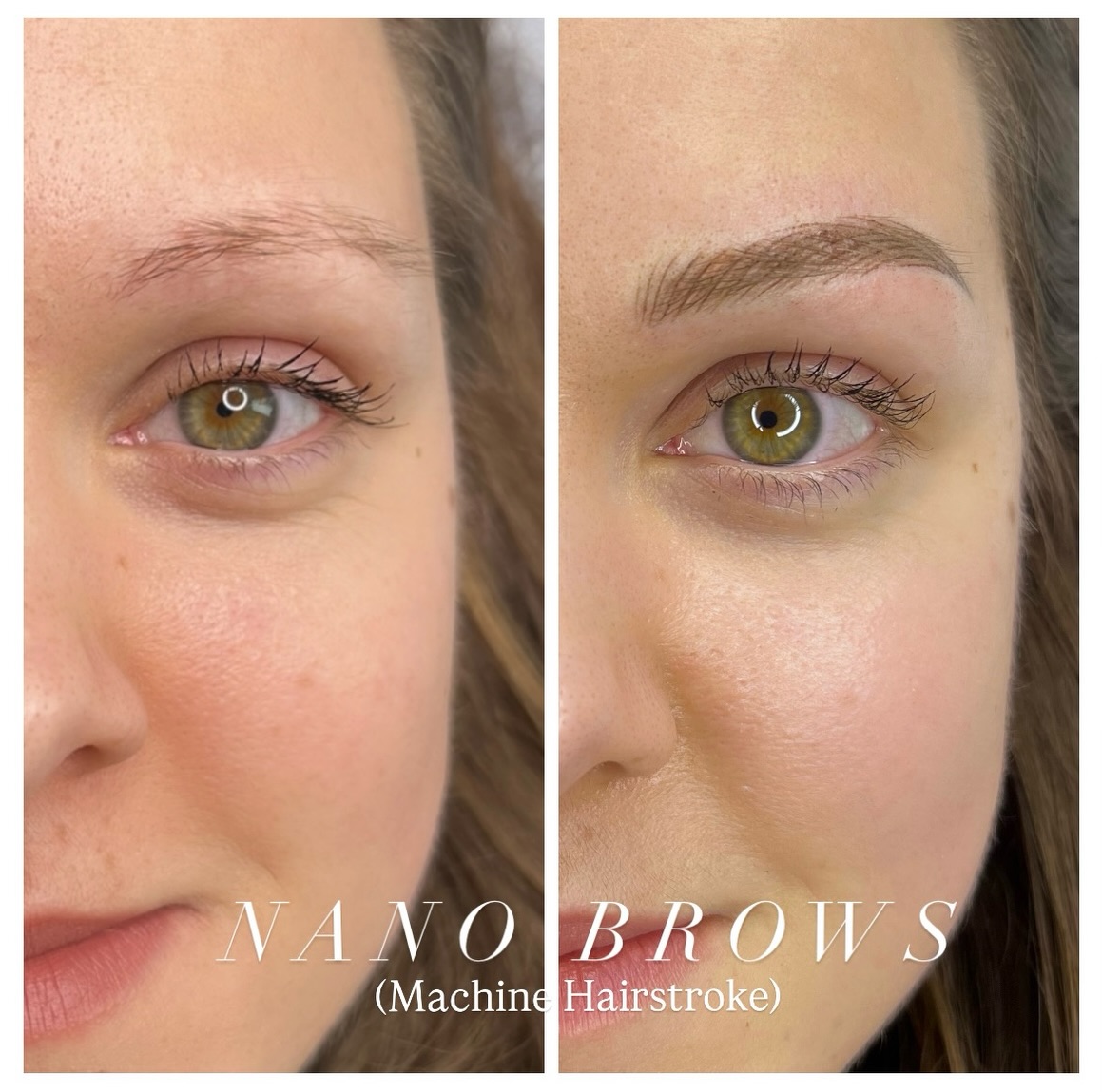 Nano Brows – Hyper-Realistic Perfection✨
The client has combination skin and wanted a natural hairstroke effect, so I performed microblading with shading. After one year, she returned for her annual touch-up. She was still happy with her existing brows, but I wasn’t satisfied with the microblading results, so I suggested switching to nano brows instead.
Microblading is not ideal for oily, combination, or sensitive skin. For clients with these skin types who still want a natural hairstroke effect, nano brows are a better option, as they are suitable for all skin types.
PhiBrows artist - SPMU specialist based in Ealing Broadway, West London.
🔖 PriceList - saved in highlight
Book your appointment now! 💕
📲 Link in bio
📩 DM or WhatsApp: +44 7399288821
#phibrowslondon #ealingmicroblading #nanobrows #hyperrealisticbrows #laserremoval