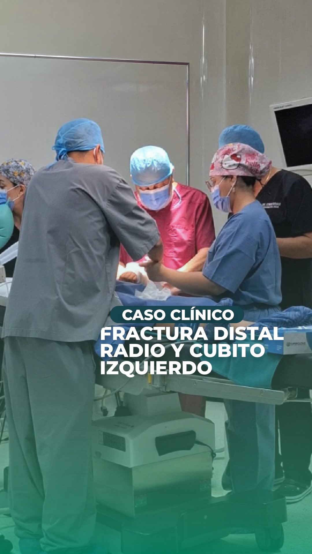 Las fracturas de muñeca son más comunes de lo que imaginas.
En este procedimiento quirúrgico, el equipo de traumatología de Clínica TOA trata una fractura distal de radio y cúbito izquierdo, recuperando la estabilidad de la articulación para que puedas volver a realizar tus actividades diarias sin problema.
Tu movilidad merece atención experta. 💪
Agenda tu cita en línea: https://www.clinicatoa.com/
☎️ 02 247 3002 | 📞 098 454 5467
#ClínicaTOA #SaludIntegral #Emergencias24h #AtenciónMédica #RehabilitaciónFísica PrevenciónEsSalud AgendáTuCita EligeTOA