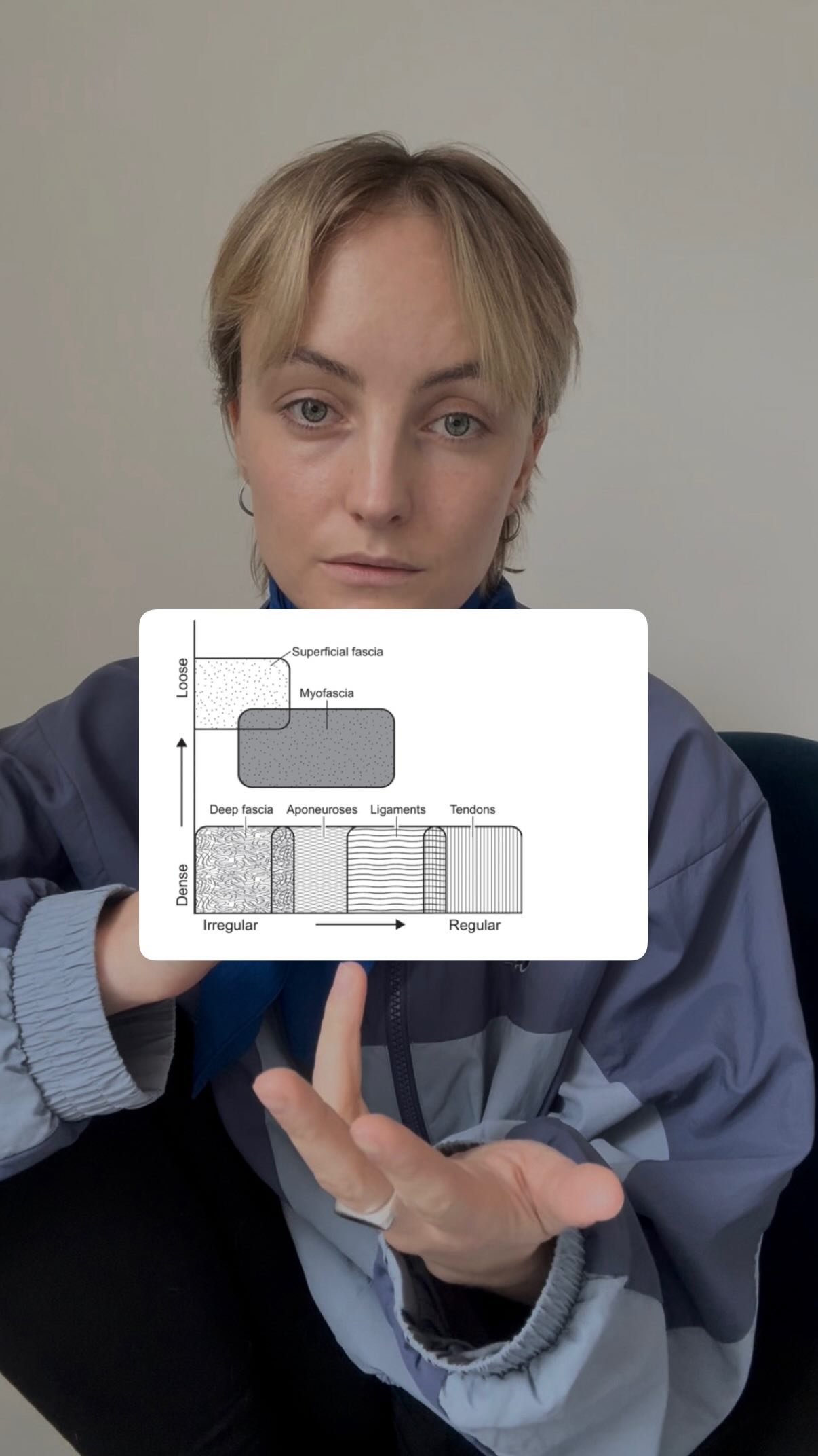 Ist eine irreguläre Fasernanordnung bei Bindegewebe immer schlecht?
Kurze Antwort: Nein, nicht immer
Lange Antwort:
✅ Unterschiedliches Bindegewebe erfüllt unterschiedliche Funktionen und sieht daher in seiner Struktur unterschiedlich aus
✅ Es bewegt sich irgendwo auf einem Spektrum zwischen regulär und irregulär sowie dicht und locker
✅ Die Form folgt dabei der Funktion. Dichte und Regelmäßigkeit sind das Ergebnis der Belastungsparameter, denen das Gewebe ausgesetzt ist
✅ Eine dichte, irreguläre Anordnung ist nicht automatisch pathologisch! Auch wenn sich das Bindegewebe bei Vernarbungen tatsächlich verändern kann, sodass eine filzartige Struktur entsteht.
Wir können also nicht ohne Weiteres sagen:
❌ Eine irreguläre Faseranordnung von Bindegewebe ist pathologisch.
💡 Wenn wir nicht klar machen, von welchem Bindegewebe wir sprechen!
PS: Warum wir im Yin Yoga vermutlich keine „verklebten“ Faszien lösen (und warum ich davon immer in Anführungszeichen spreche) erfährst du in meiner Weiterbildung.
📅📅📅📅
10.04.26 – 12.04.26
Berlin/Prenzlauer Berg
Es gibt noch einen freien Platz!
❕Meine einzige Yin-Yoga-Weiterbildung dieses Jahr!