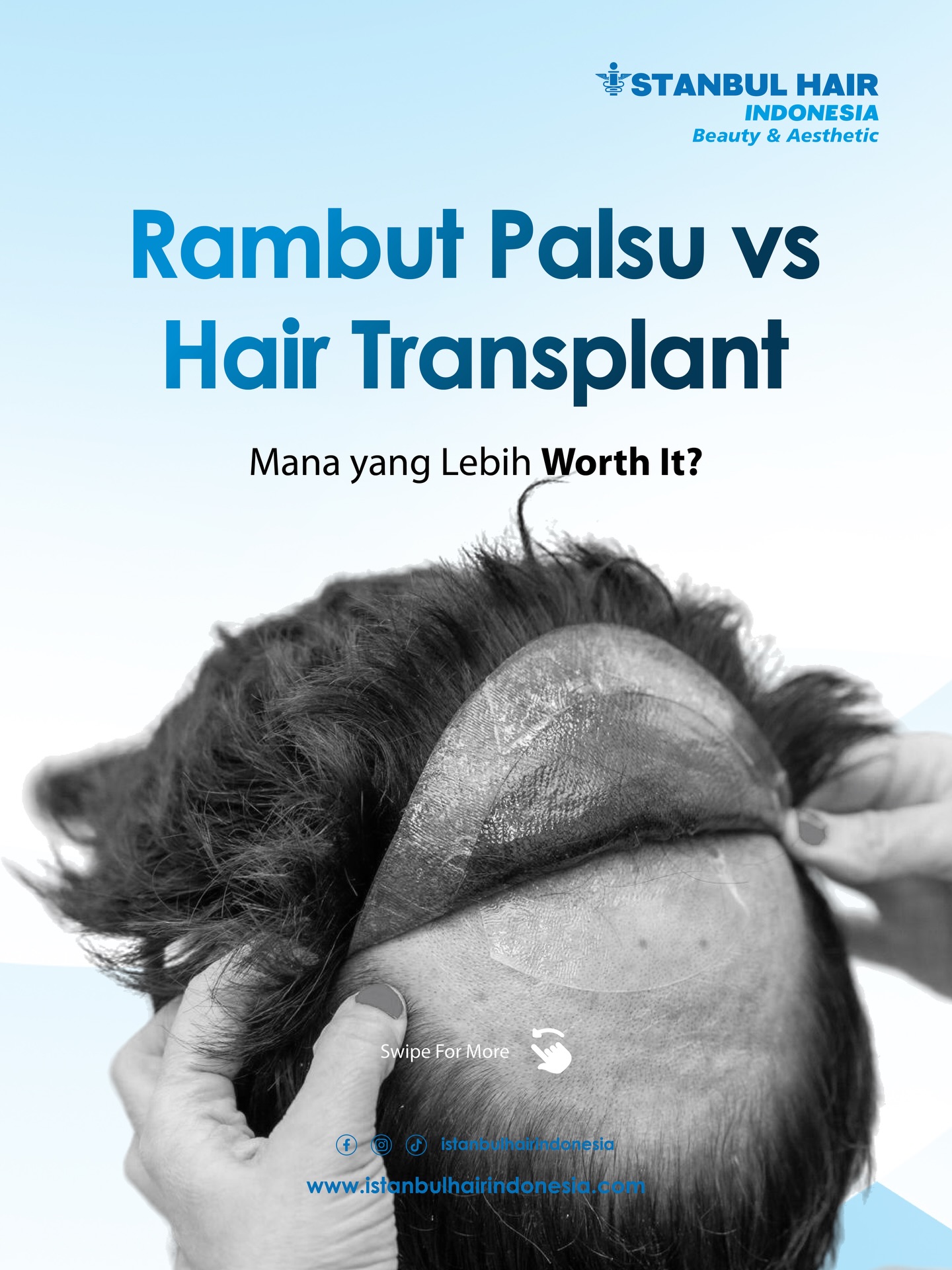 Tidak semua solusi itu sama.
Ada yang hanya menutupi, ada yang benar-benar mengembalikan.
Hair transplant bukan sekadar prosedur,
melainkan investasi jangka panjang untuk penampilan dan rasa percaya diri Anda.
Hasil yang tumbuh alami, menyatu sempurna,
dan dapat Anda rawat seperti rambut sendiri—tanpa batasan, tanpa kekhawatiran.
Karena tampil percaya diri bukan lagi pilihan,
melainkan standar baru.
Mulai perjalanan Anda hari ini bersama Istanbul Hair Indonesia. ✨
Hubungi kami untuk konsultasi eksklusif.
#IstanbulHairIndonesia #HairTransplantIndonesia #SolusiKebotakan #PercayaDiriLagi #AestheticClinicIndonesia