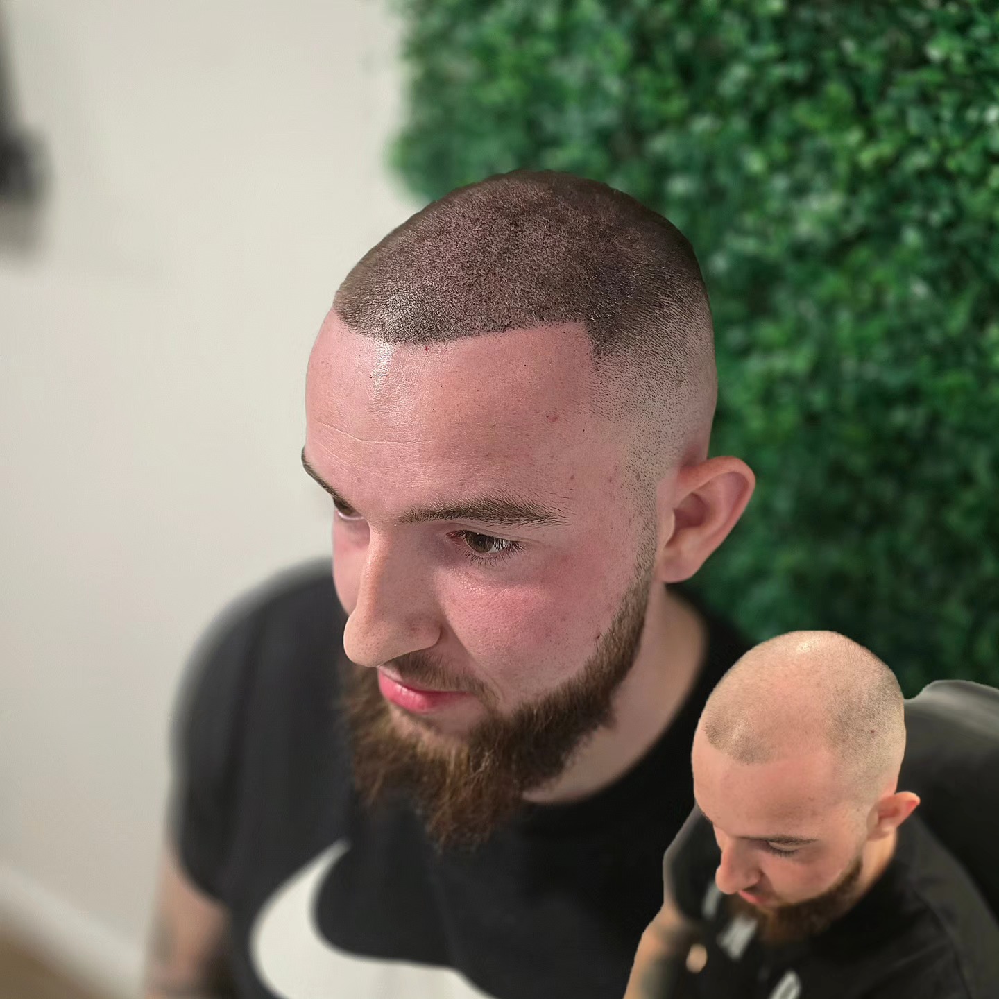 SCALP MICRO-PIGMENTATION
FULL HEAD DENSITY TREATMENT
Loved this result with a barbershop shape up, faded temples and loads of density added to the top of the head!
Scalp Micro-Pigmentation is the perfect hair loss solution for those who want a low cost, effective hair loss remedy with results from the very first session!
📍Bury St Edmunds, Suffolk, UK
📍Brighton, UK
#scalppigmentation #scalpmicropigmentation #smp #hairloss #hairlosssolution #hairlosstreatment #hairlossremedy #scalp #tattoo #hairlosstattoo #hairloss #thinhair #balding #bald #recedinghairline #hairtattoo #barber #skinfade #menshair #newhair #newhaircut #buzzfade #buzzcut #shave #beard
