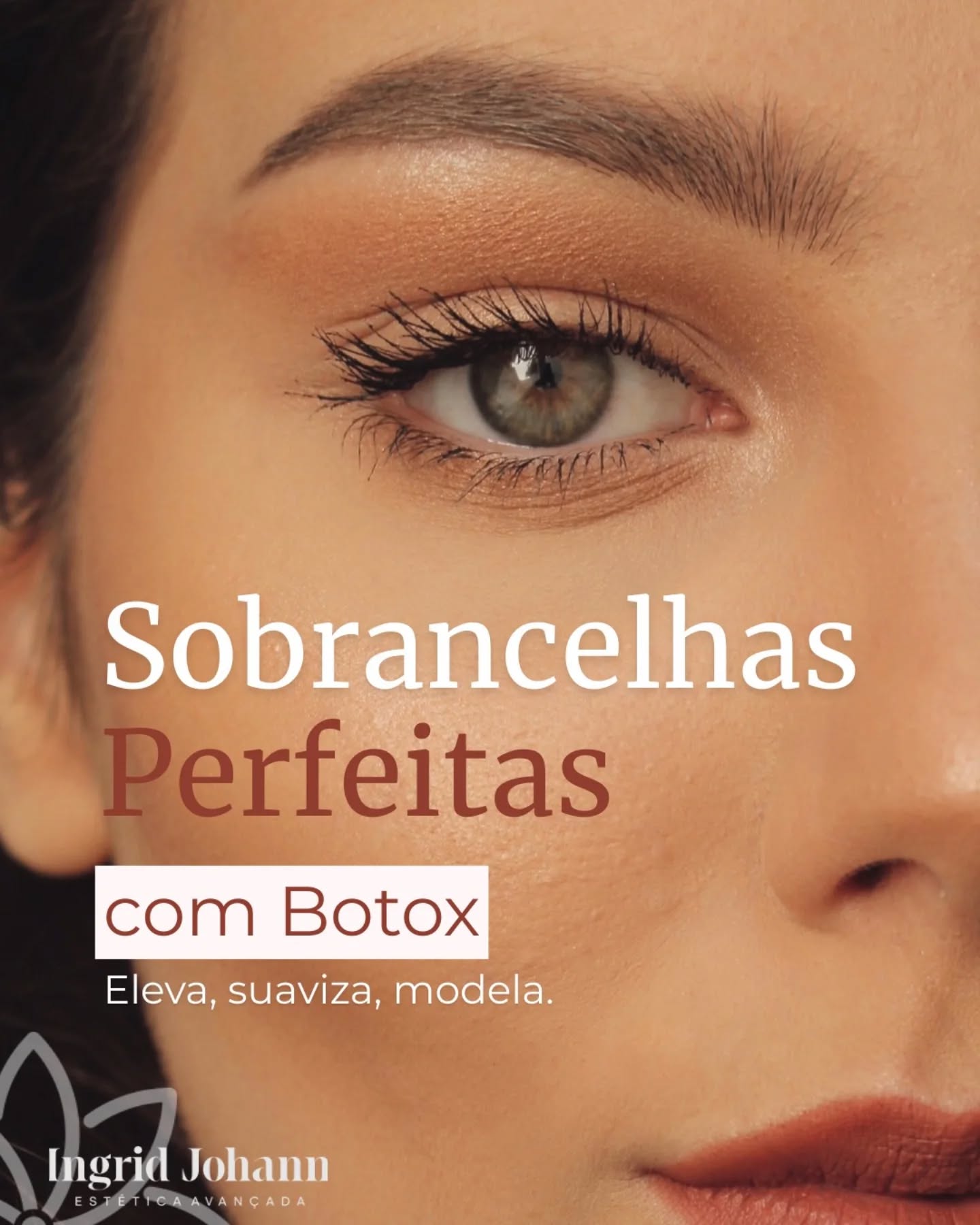 As sobrancelhas moldam a expressão do rosto.
Com a aplicação estratégica da toxina botulínica é possível:
✔️ Elevar o olhar
✔️ Suavizar a expressão cansada
✔️ Corrigir pequenas assimetrias
✔️ Modelar o arco de forma natural
O resultado?
Um olhar mais leve, descansado e harmonioso — sem exageros.
A diferença está na técnica e na avaliação individualizada.
📍 Agende sua avaliação.
#botox #toxinabotulinica #liftingdesobrancelhas #harmonizacaofacia #olharmarcante