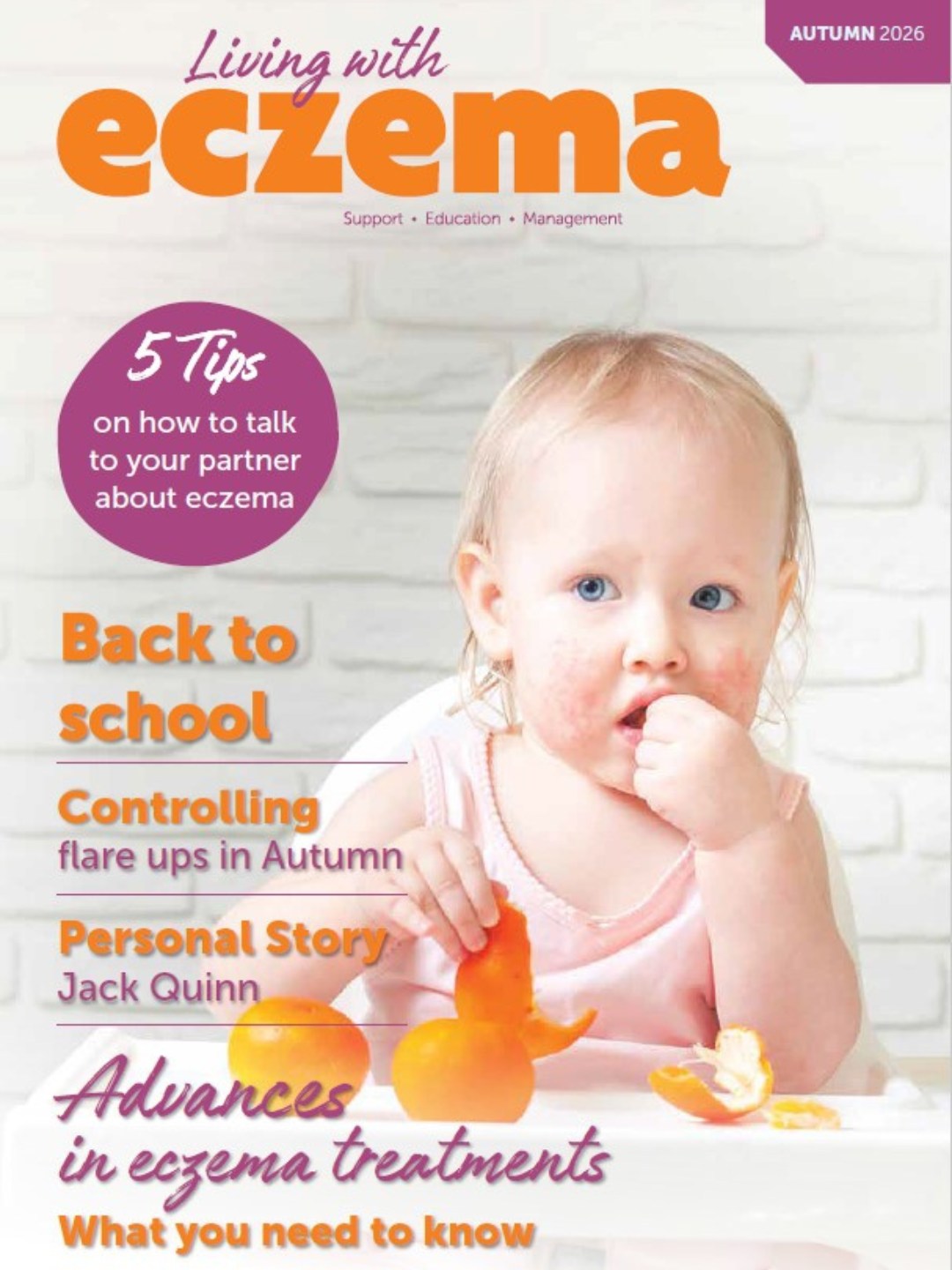 We’ve had a steady and productive month at the Eczema Association of New Zealand. Our team has been focused on distributing our updated information packs to medical centres across Aotearoa, as well as continuing to provide information and support to individuals and families in the community.
Although it’s been a relatively quiet month in terms of major events, we’ve been working behind the scenes to strengthen relationships with other not-for-profit organisations and explore opportunities for resource sharing and collaboration.
We’re also pleased to share that our latest autumn edition of Living with Eczema is now available, with the digital version accessible through the members portal for our community to enjoy.
We’d like to extend a heartfelt thank you to our EANZ community. Your ongoing support, encouragement, and willingness to share your experiences continue to guide the work we do. Whether you’ve reached out for information, connected with us online, or helped spread awareness in your own circles, every action helps us support more people living with eczema across Aotearoa. We truly appreciate you.
#eczema #eczemasupport