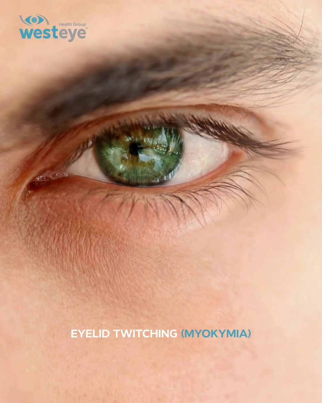 Before you panic about that eye twitch.
Relax, it’s usually temporary and harmless.
But if it keeps coming back, don’t ignore it.
#westeyehospitals